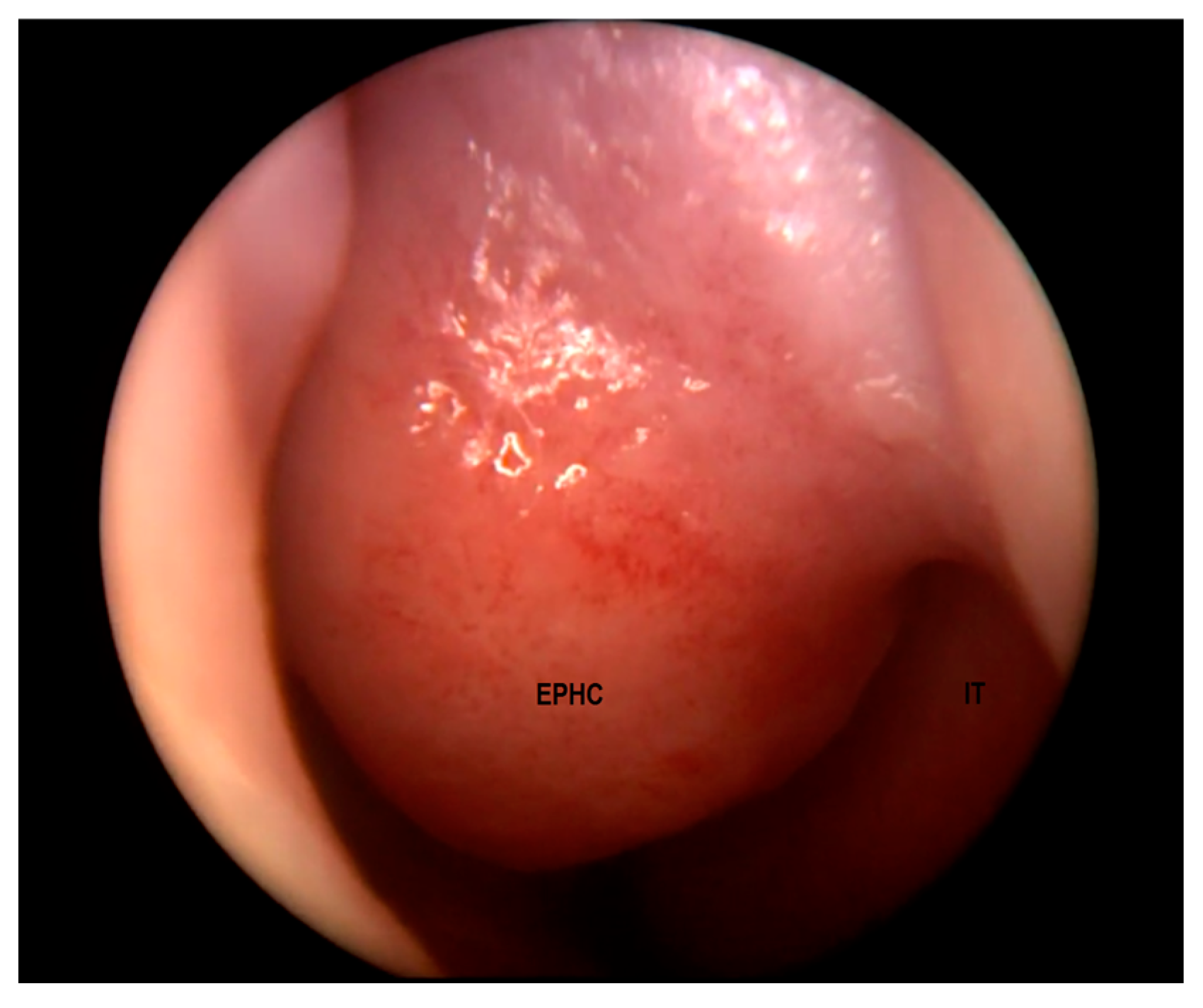 Diagnostics 13 02796 g002 Diagnostics 13 02796 g002