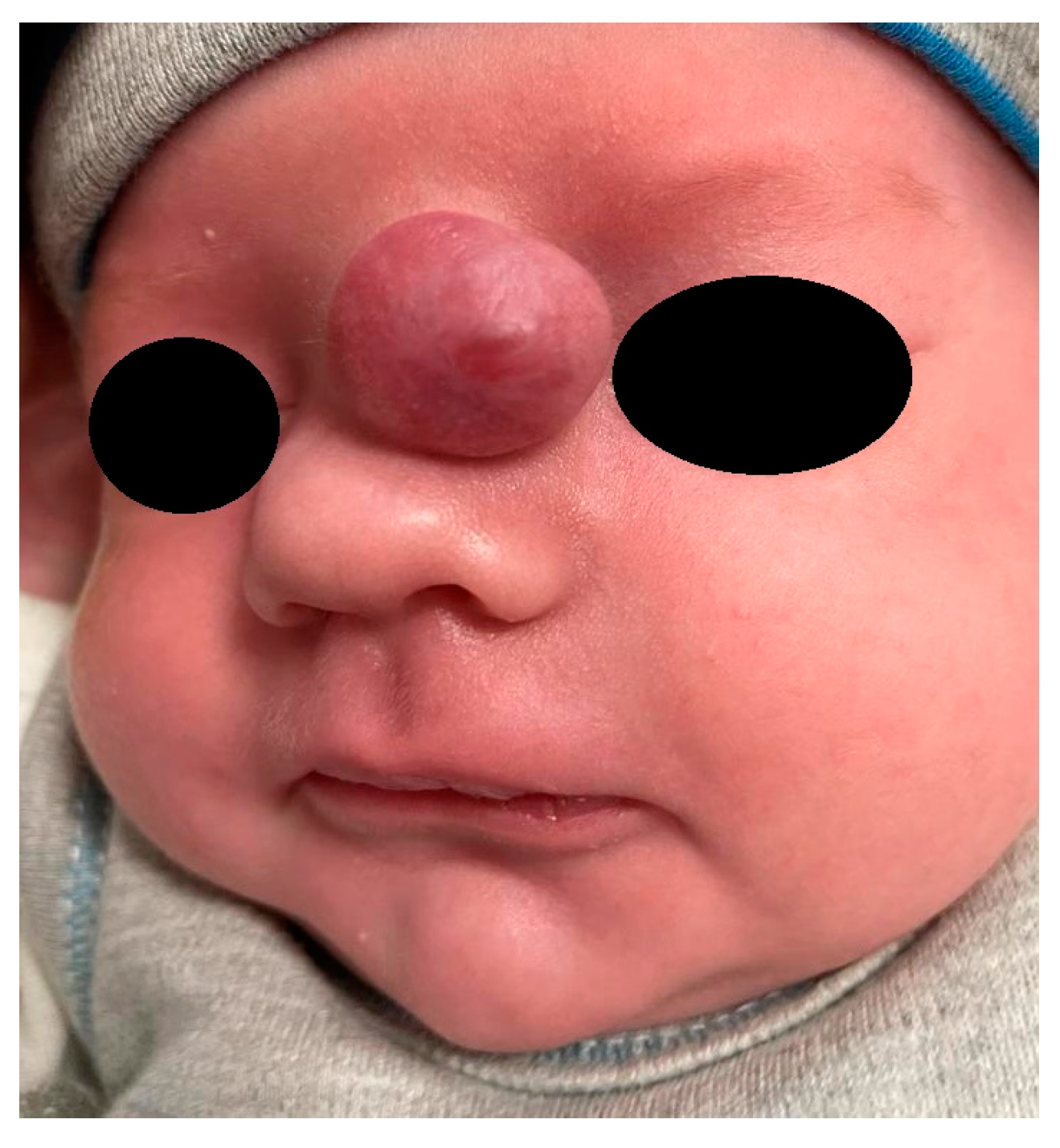 Diagnostics 13 02796 g003 Diagnostics 13 02796 g003