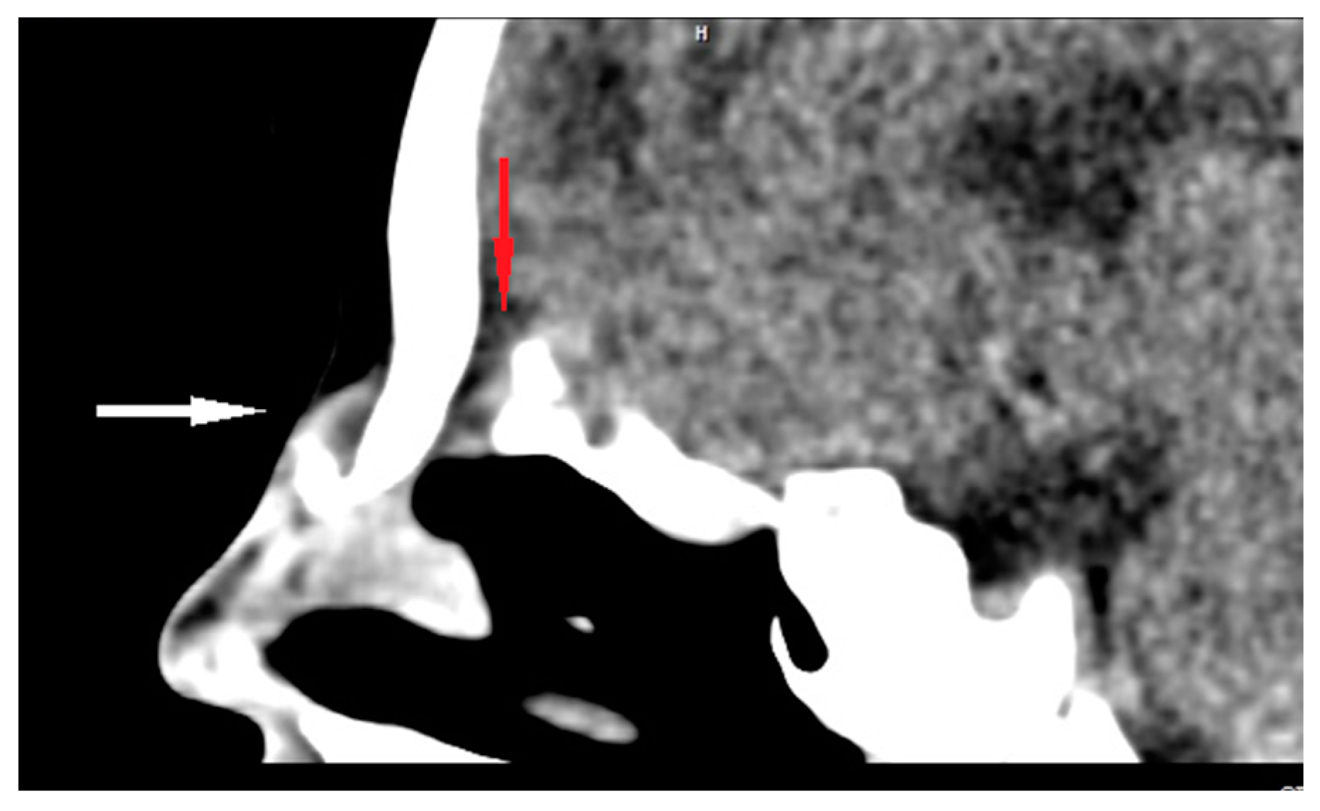 Diagnostics 13 02796 g004 Diagnostics 13 02796 g004