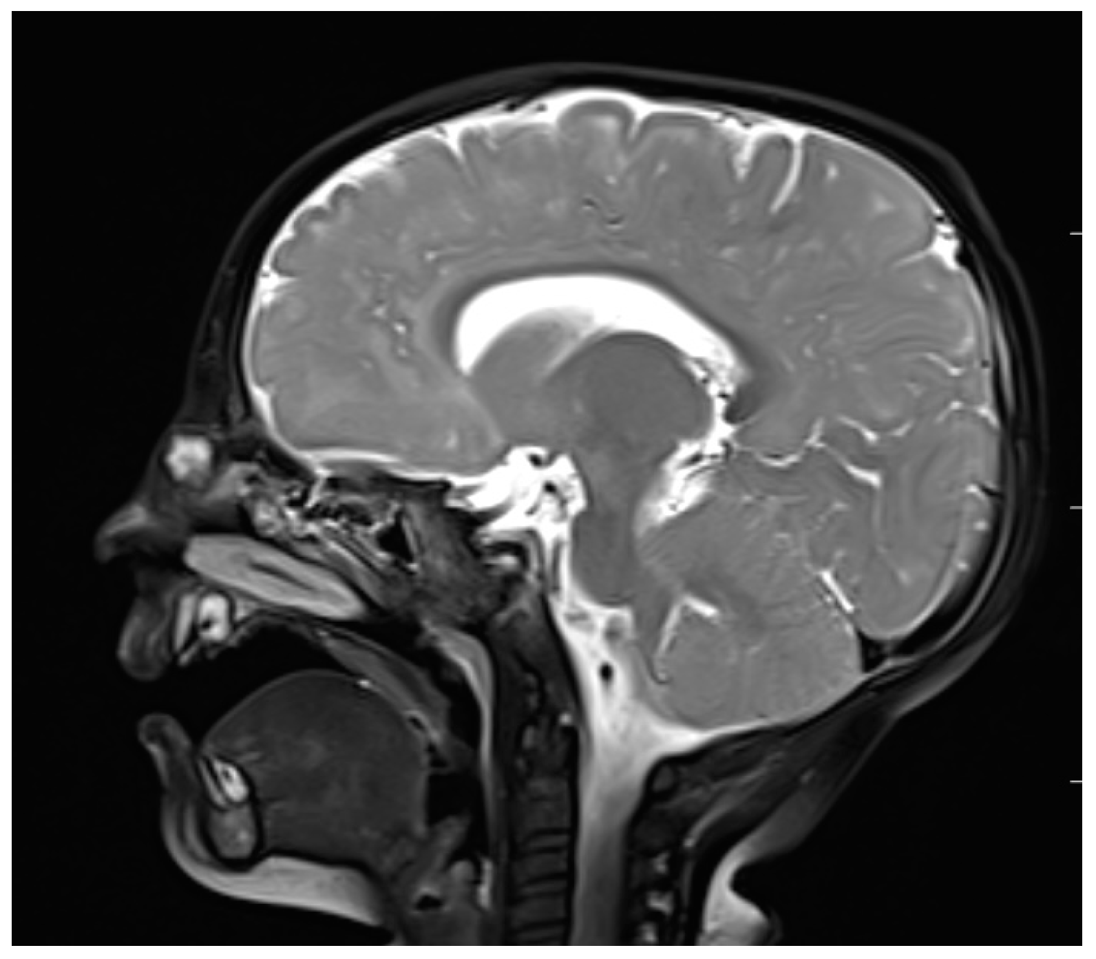 Diagnostics 13 02796 g005 Diagnostics 13 02796 g005