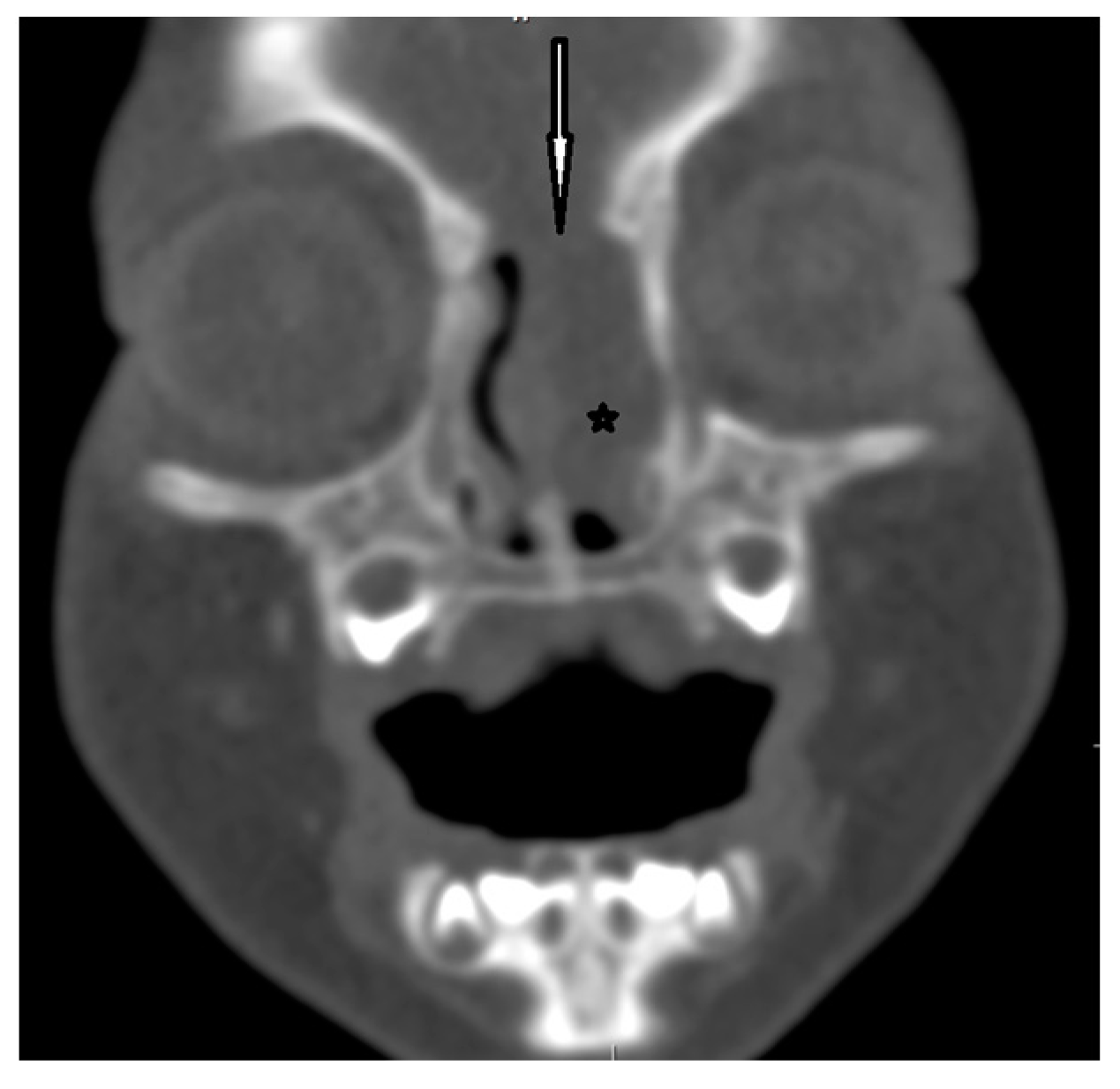 Diagnostics 13 02796 g007 Diagnostics 13 02796 g007