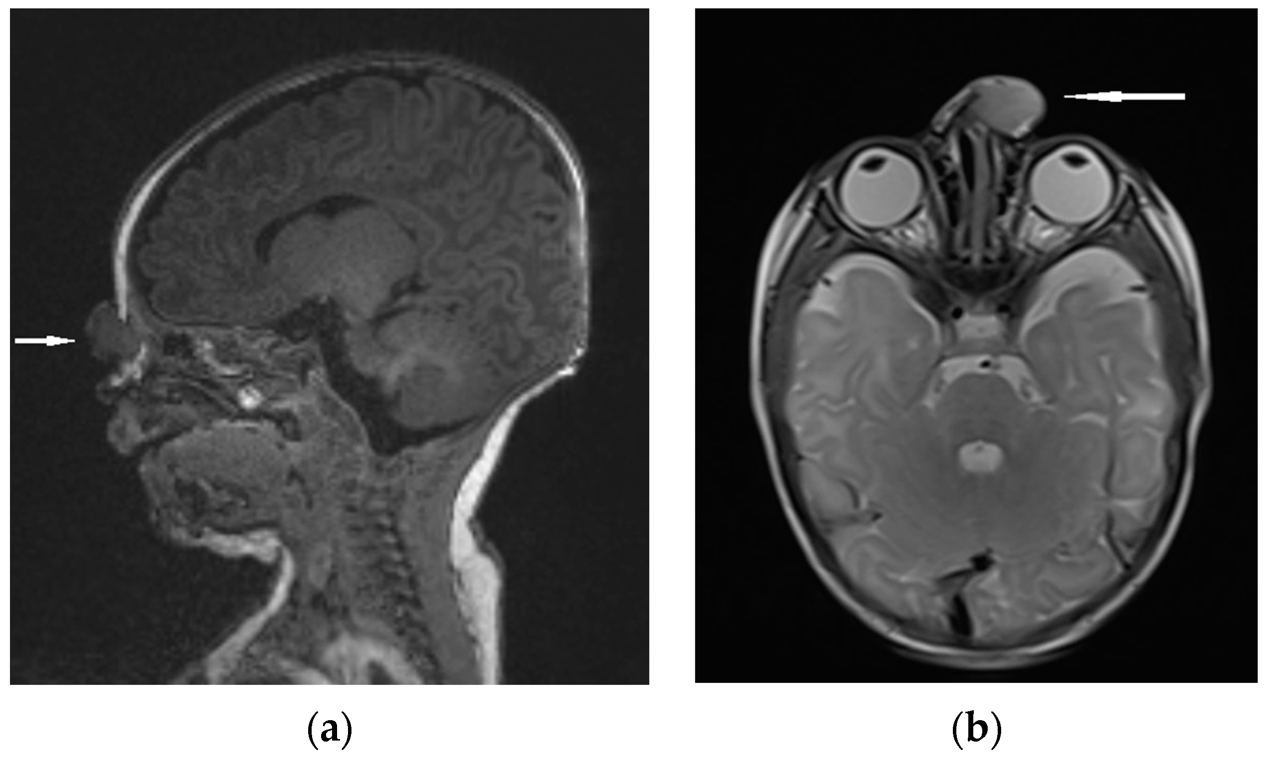 Diagnostics 13 02796 g008 Diagnostics 13 02796 g008
