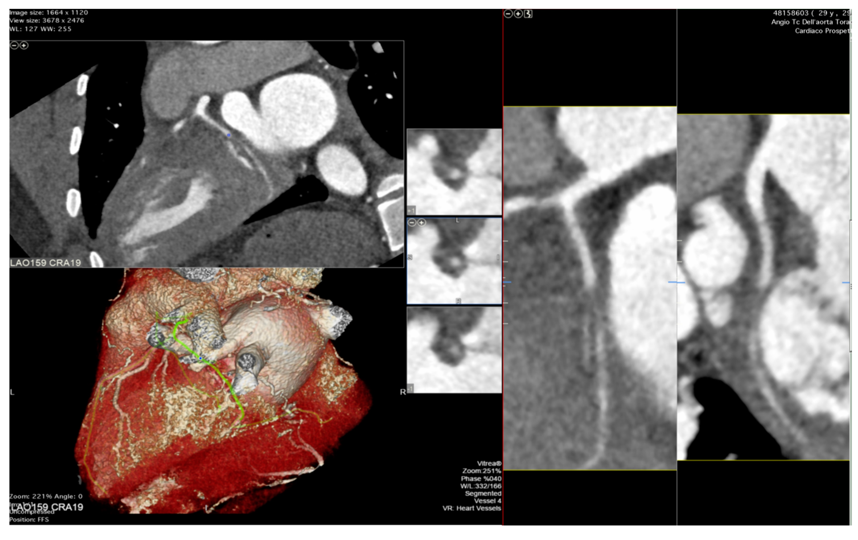 Diagnostics 13 02818 g003 Diagnostics 13 02818 g003