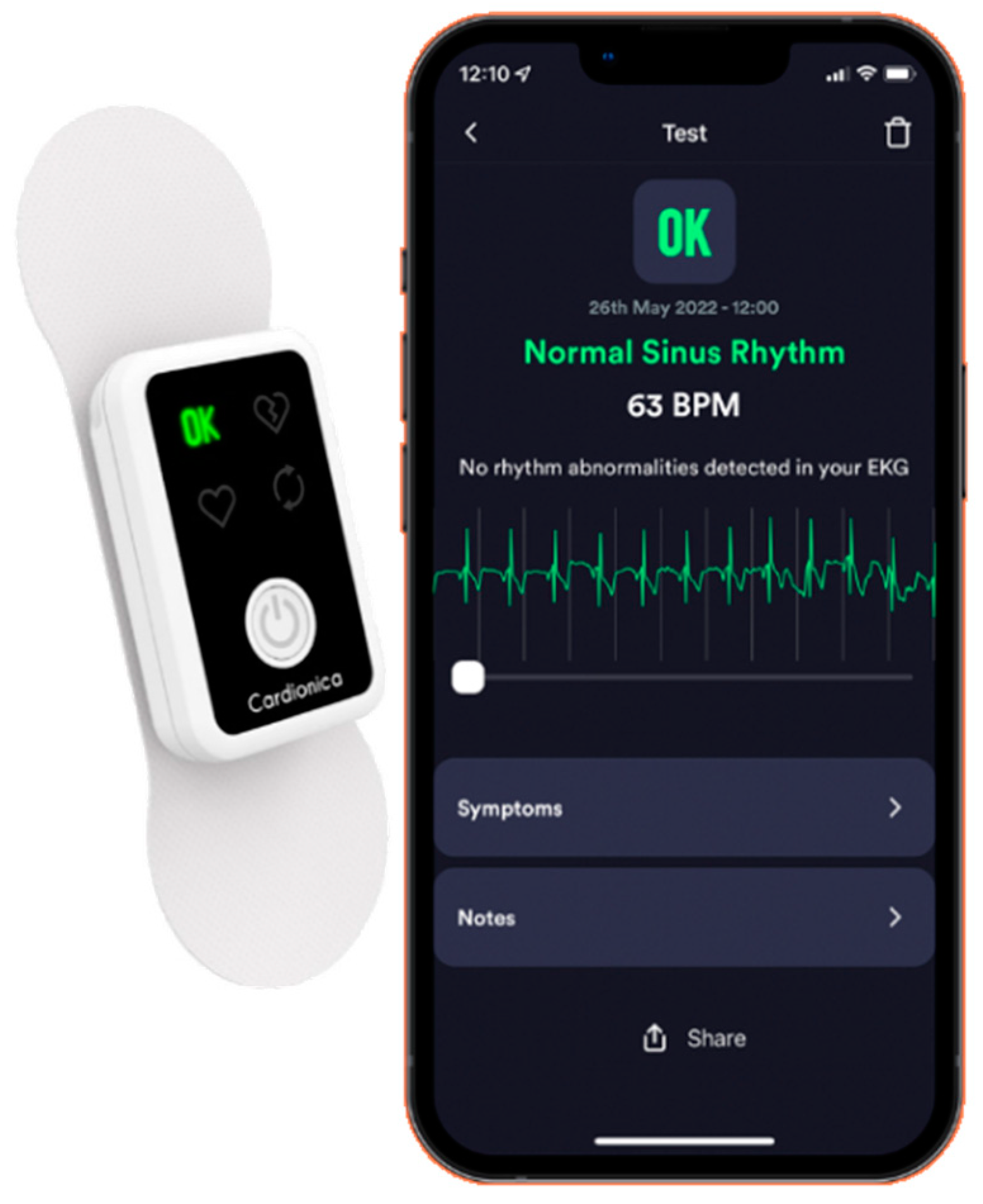 Diagnostics | Free Full-Text | Personalized Antiarrhythmic Therapy Using a  Self-Managed Daily-ECG Device