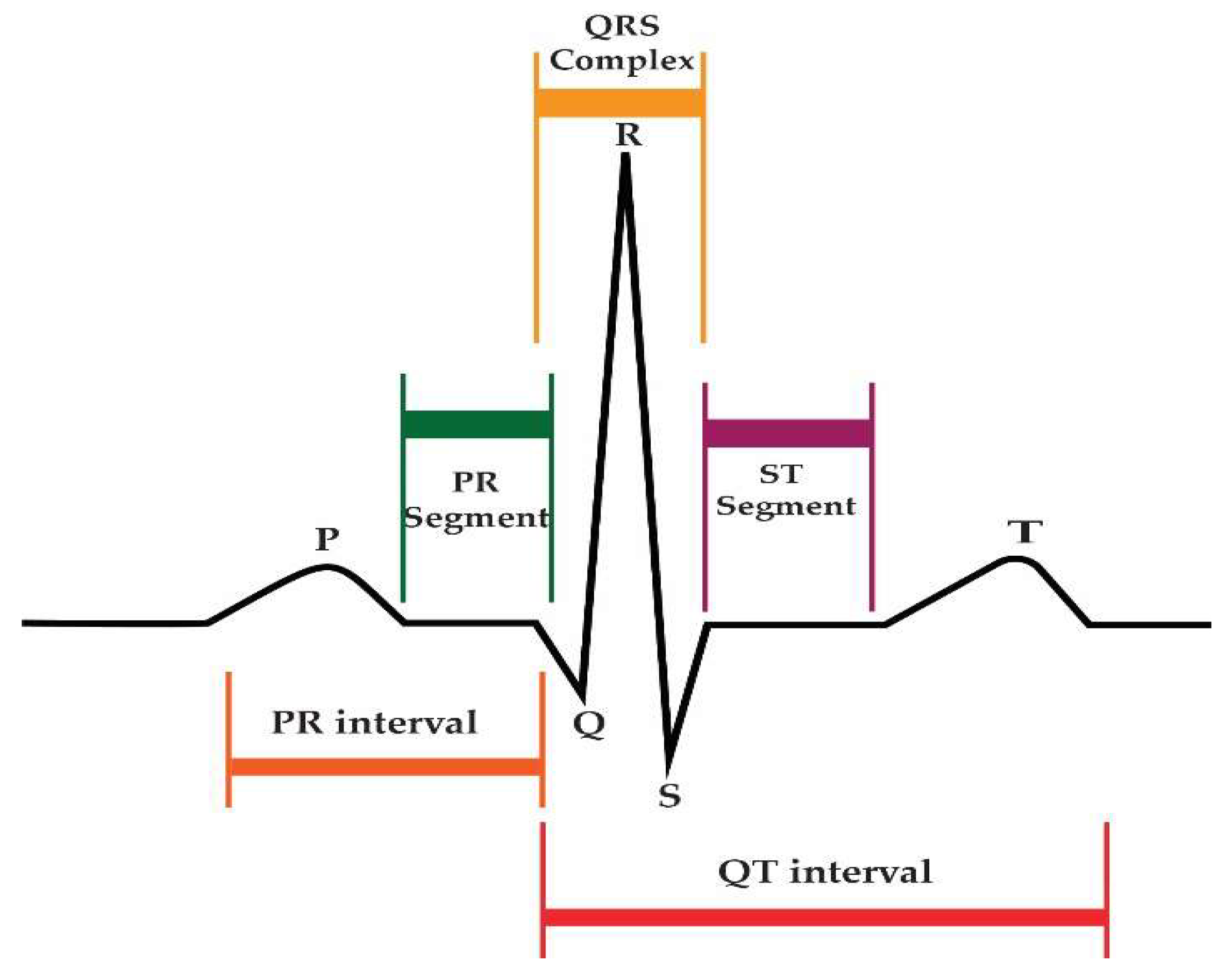 Diagnostics | Free Full-Text | Reseek-Arrhythmia: Empirical Evaluation ...