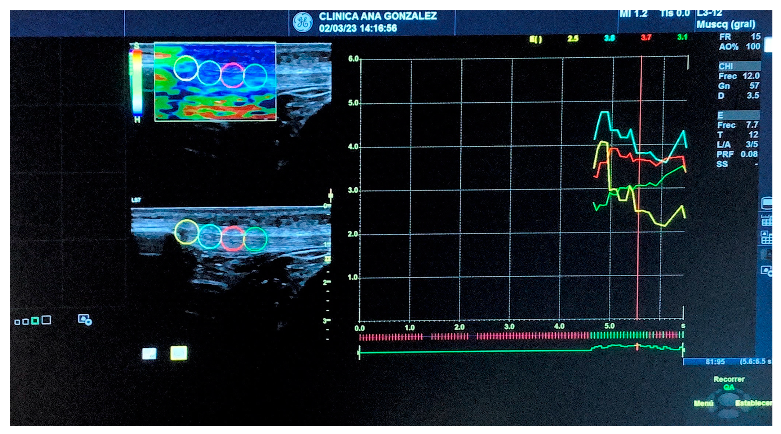 Diagnostics 13 02976 g002 Diagnostics 13 02976 g002