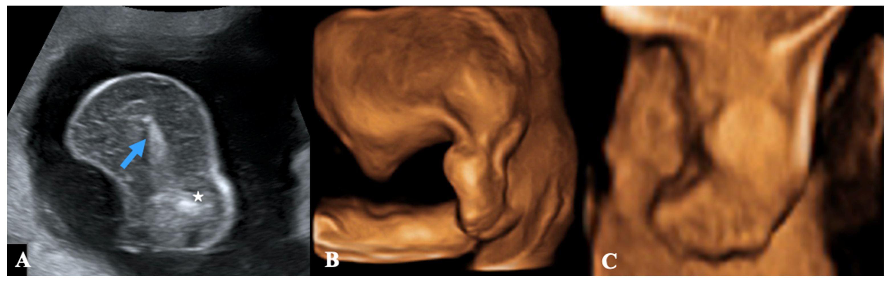 Baby Scales: DW-22