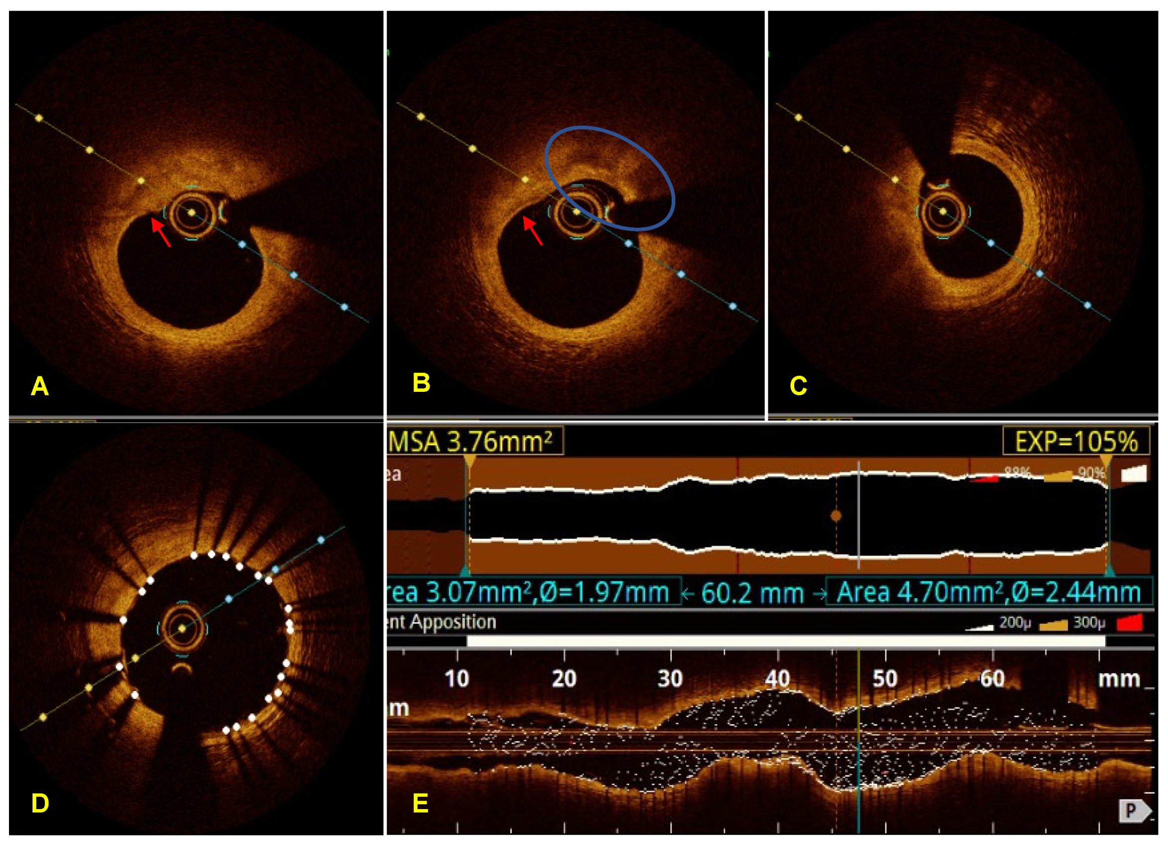 Diagnostics 13 03118 g003 Diagnostics 13 03118 g003