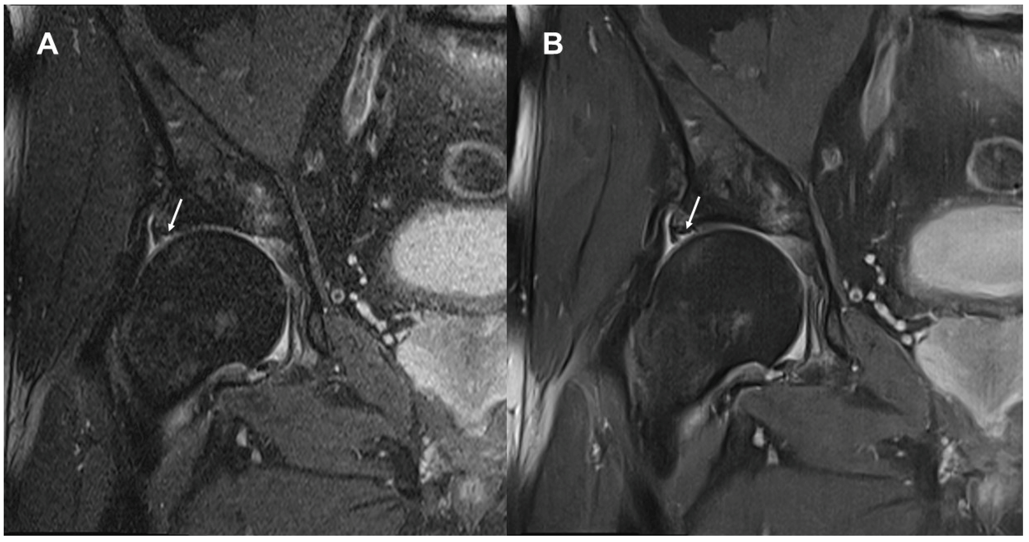 Diagnostics 13 03241 g003 Diagnostics 13 03241 g003