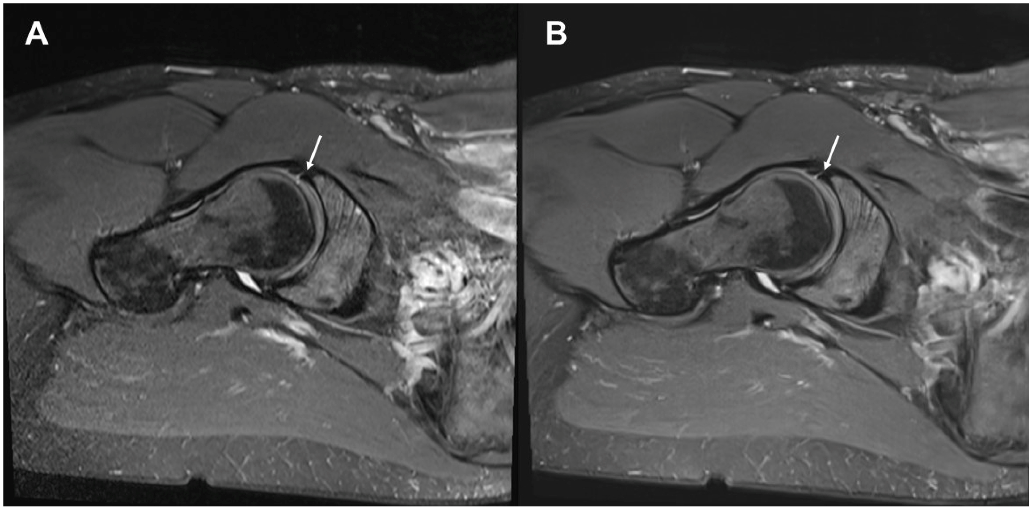 Diagnostics 13 03241 g004 Diagnostics 13 03241 g004