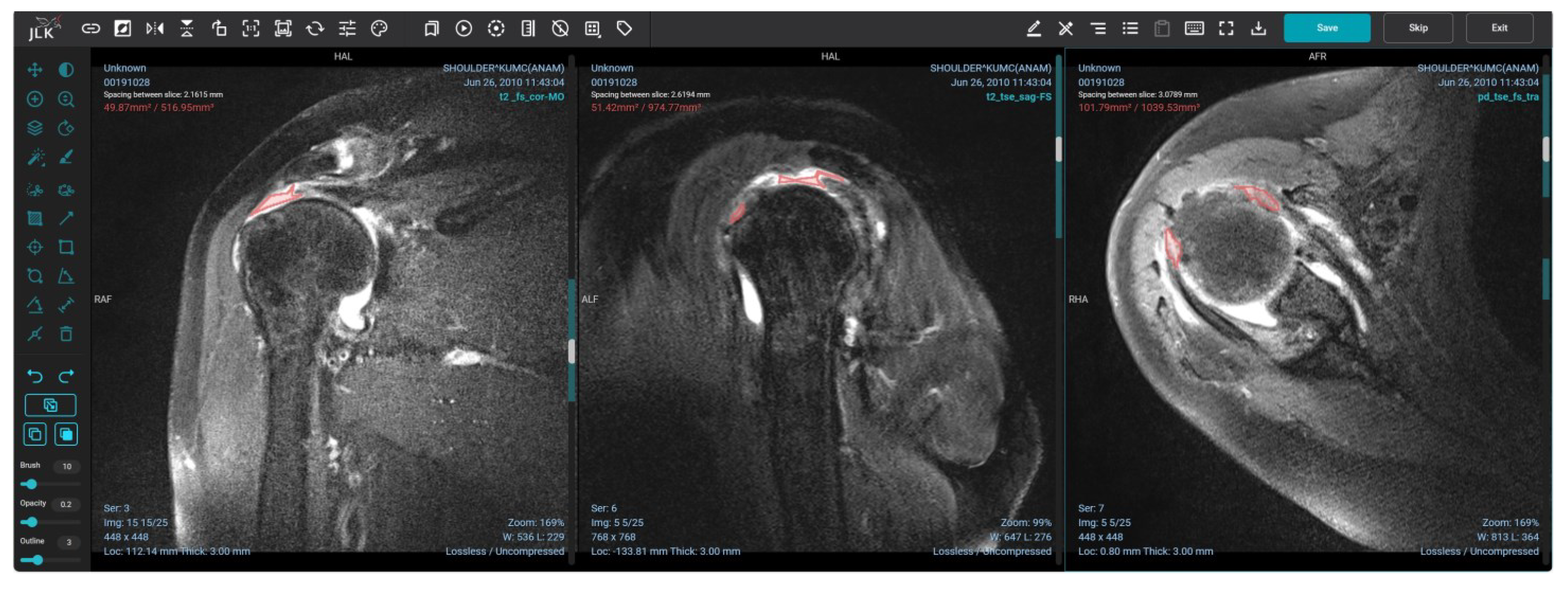 Diagnostics 13 03254 g002 Diagnostics 13 03254 g002