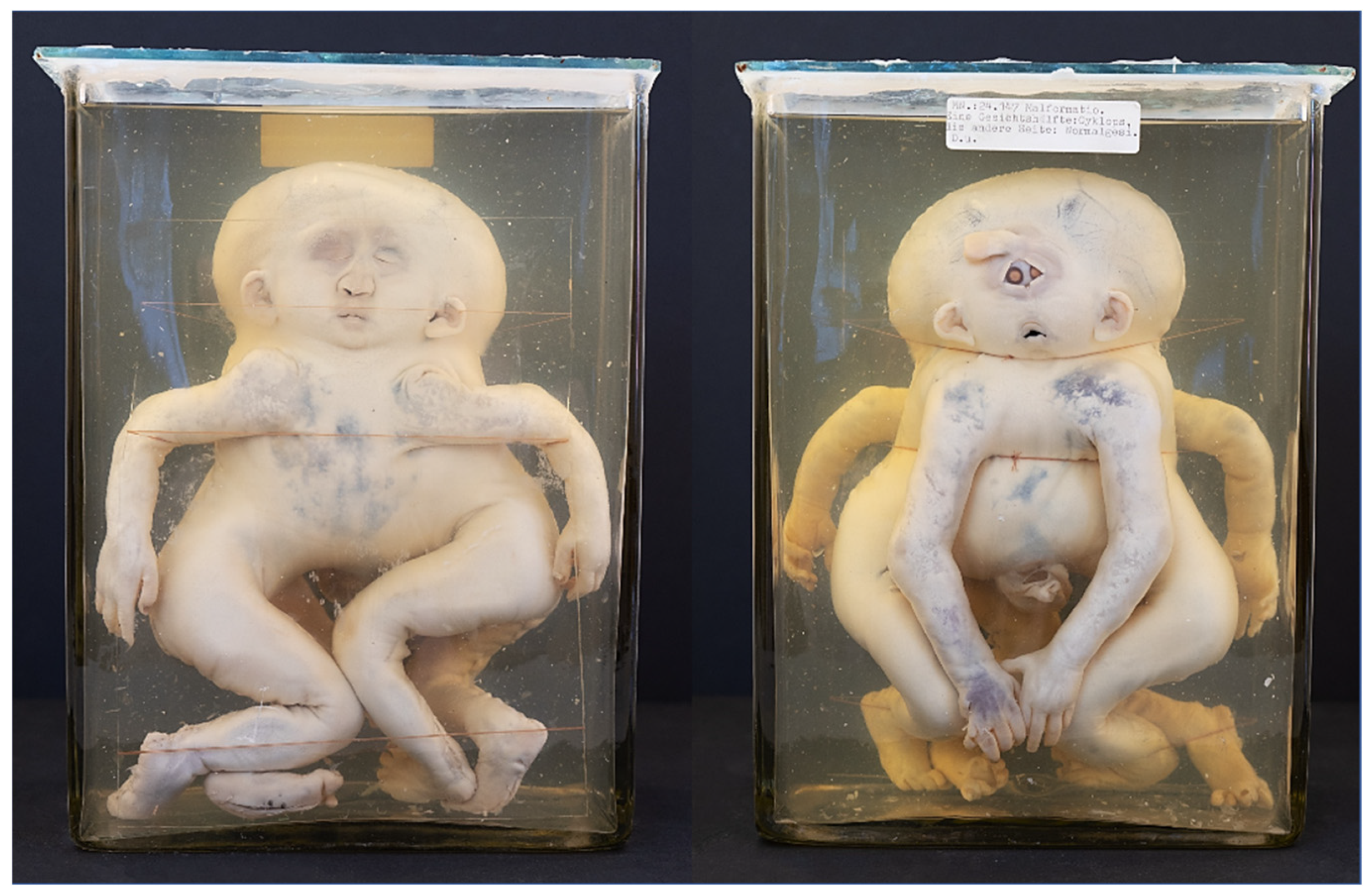 Diagnostics 13 03427 g002