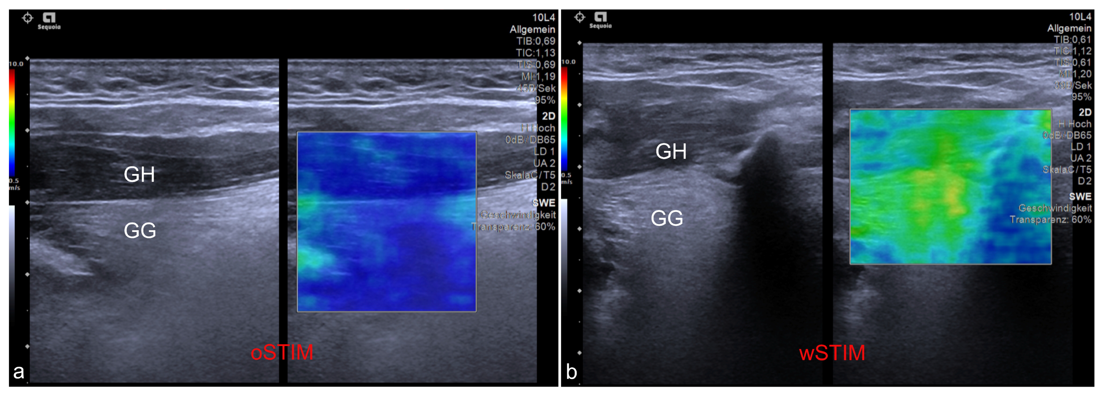 Diagnostics 13 03493 g002