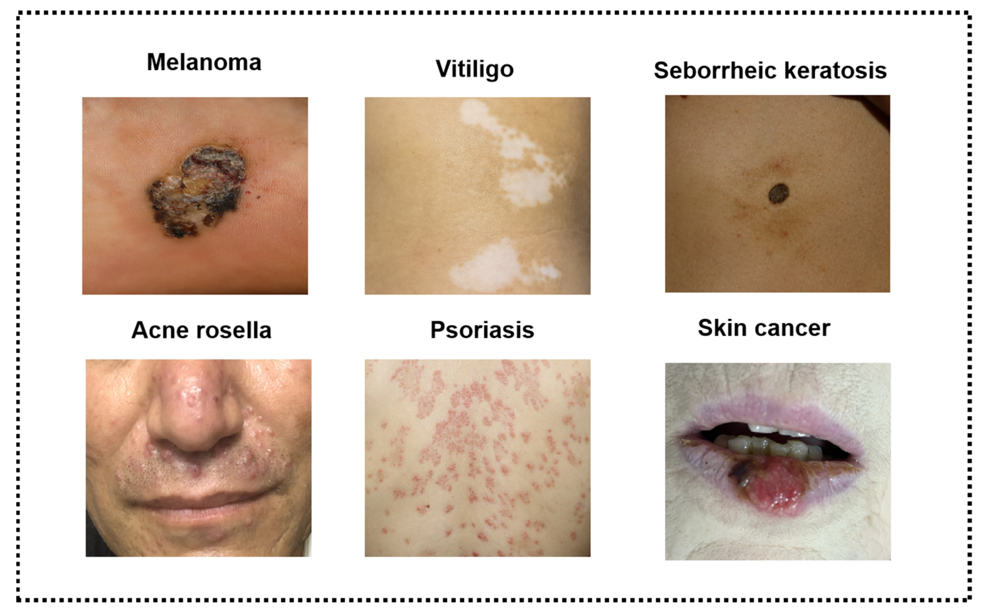 Female Genital Skin Conditions, Dermatology