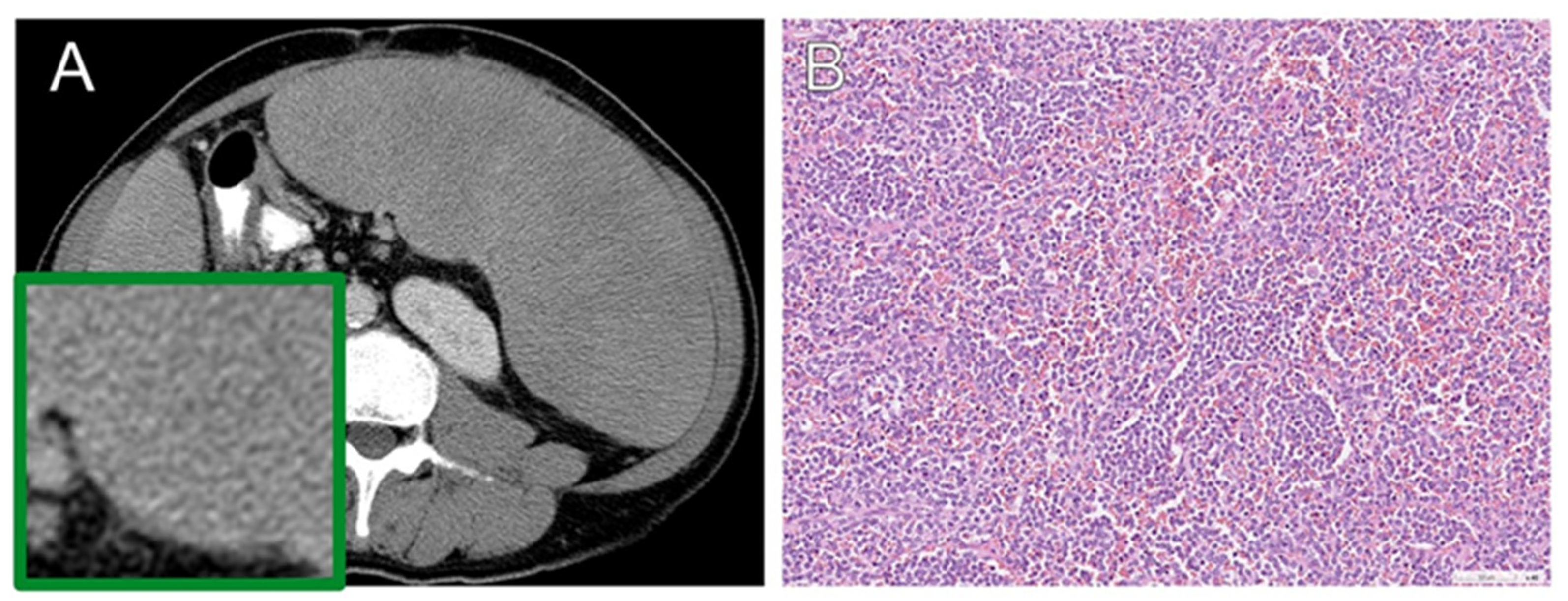 Diagnostics 13 03632 g003