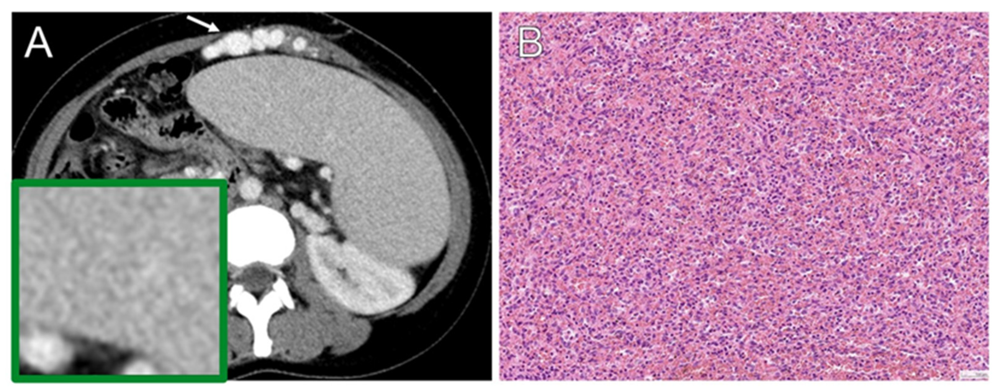 Diagnostics 13 03632 g004