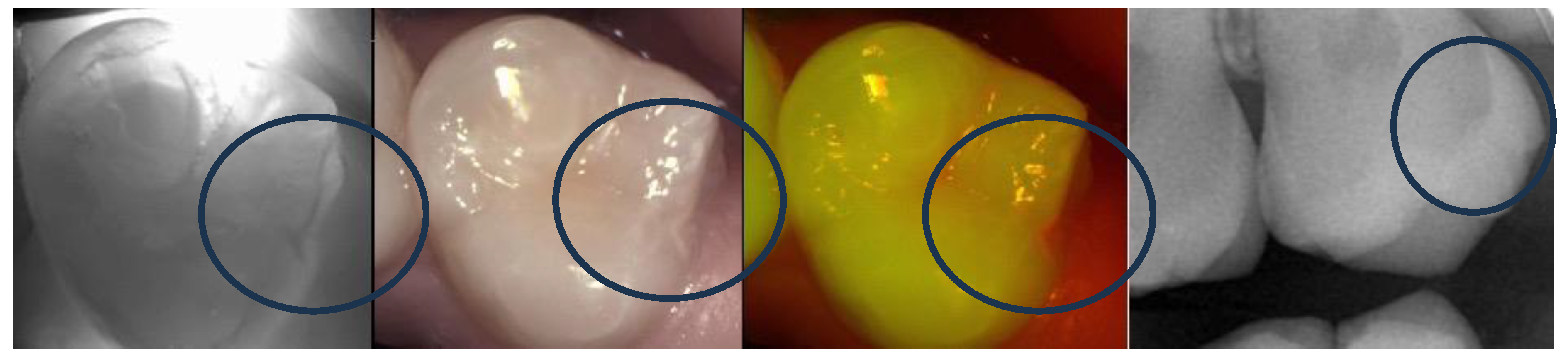 Diagnostics 13 03649 g005