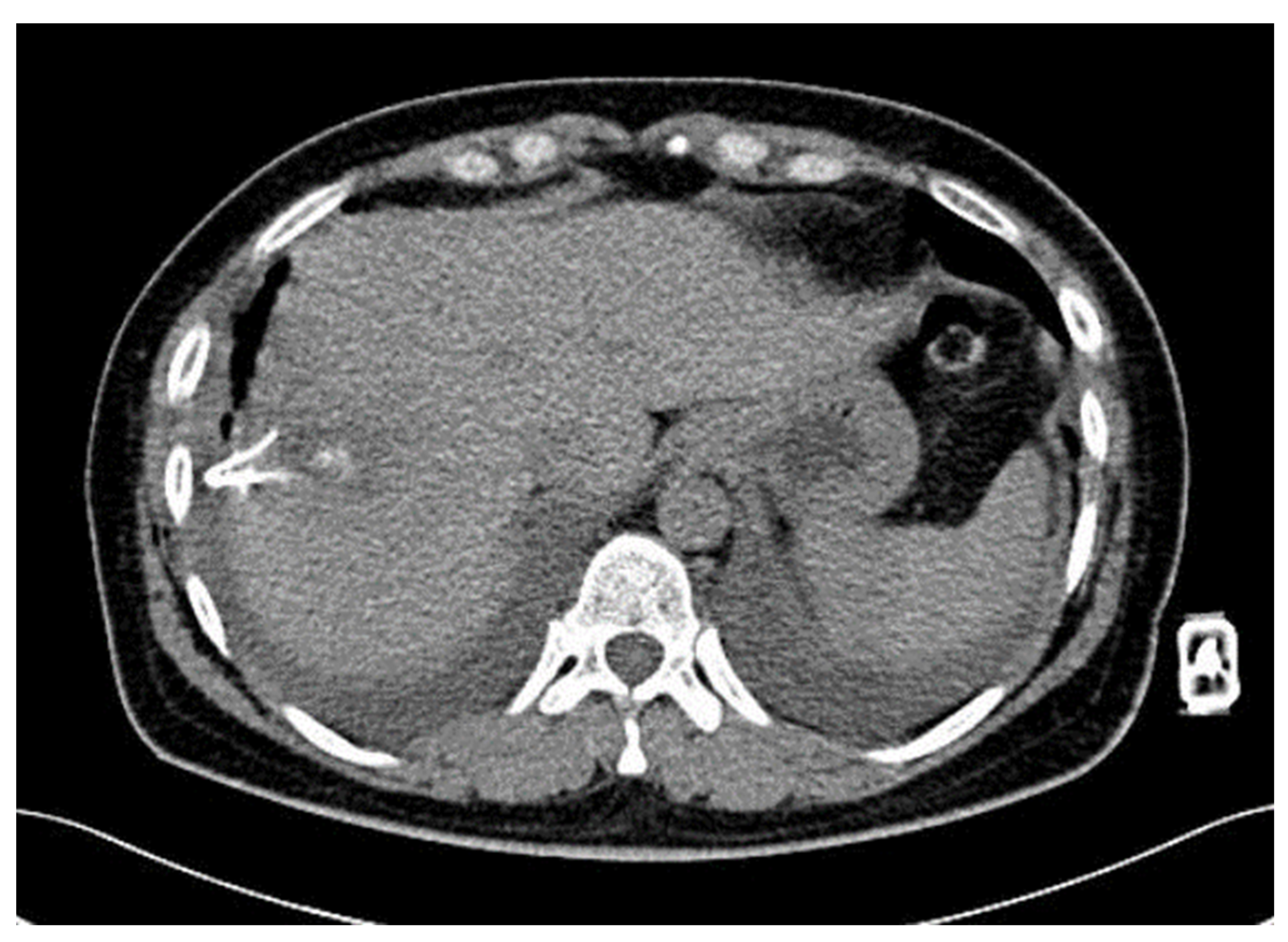 Diagnostics 14 00026 g002