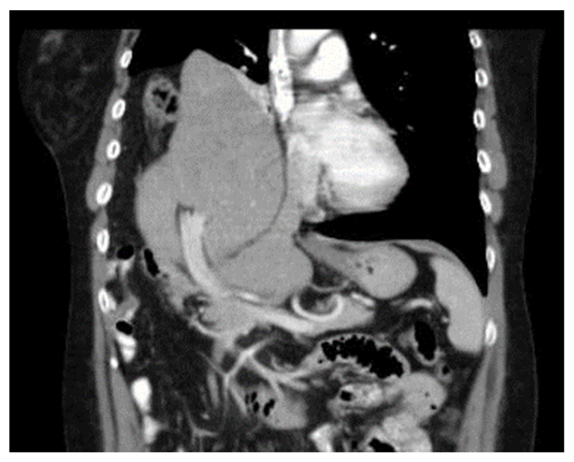 Diagnostics 14 00026 g004