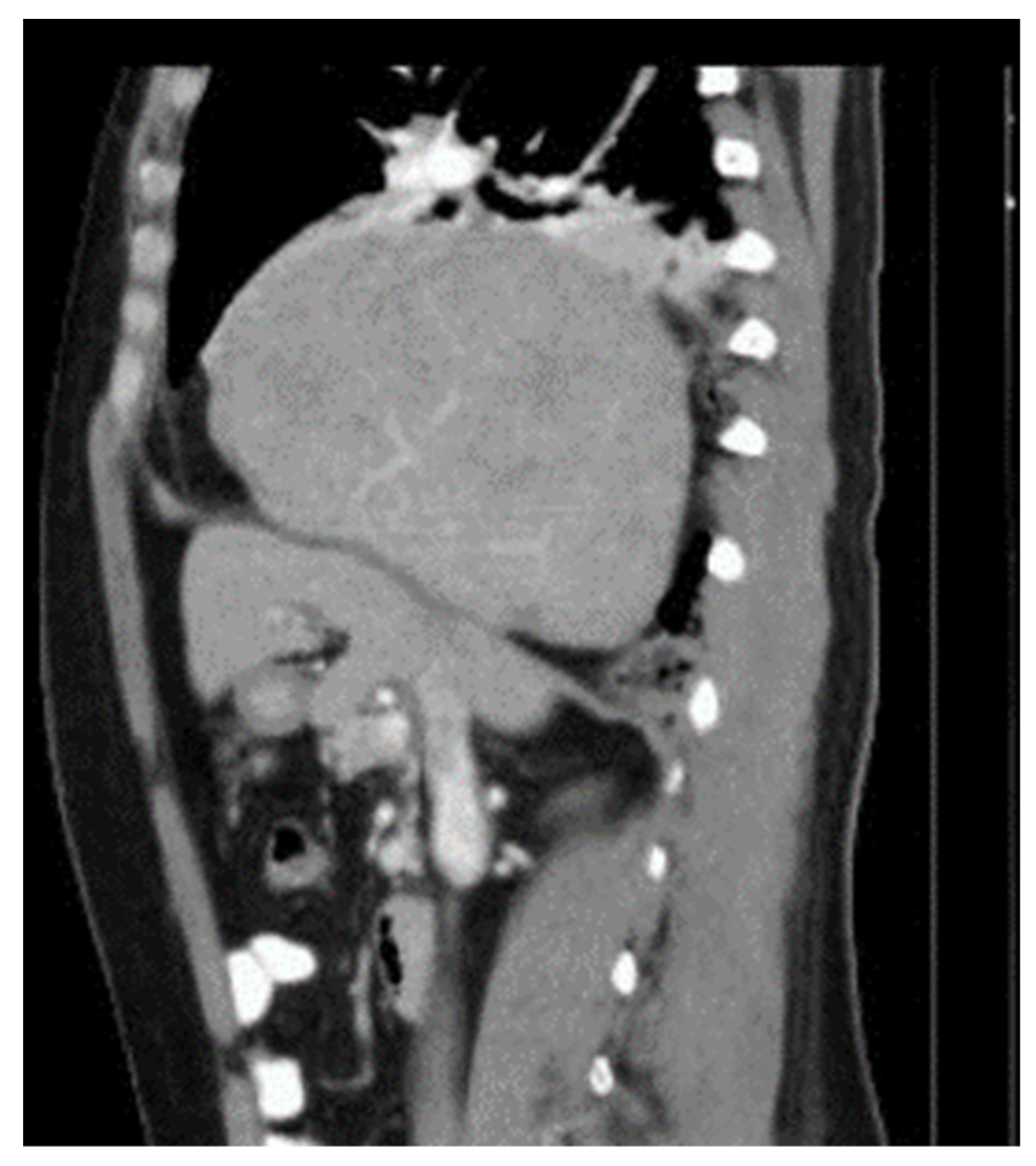 Diagnostics 14 00026 g005