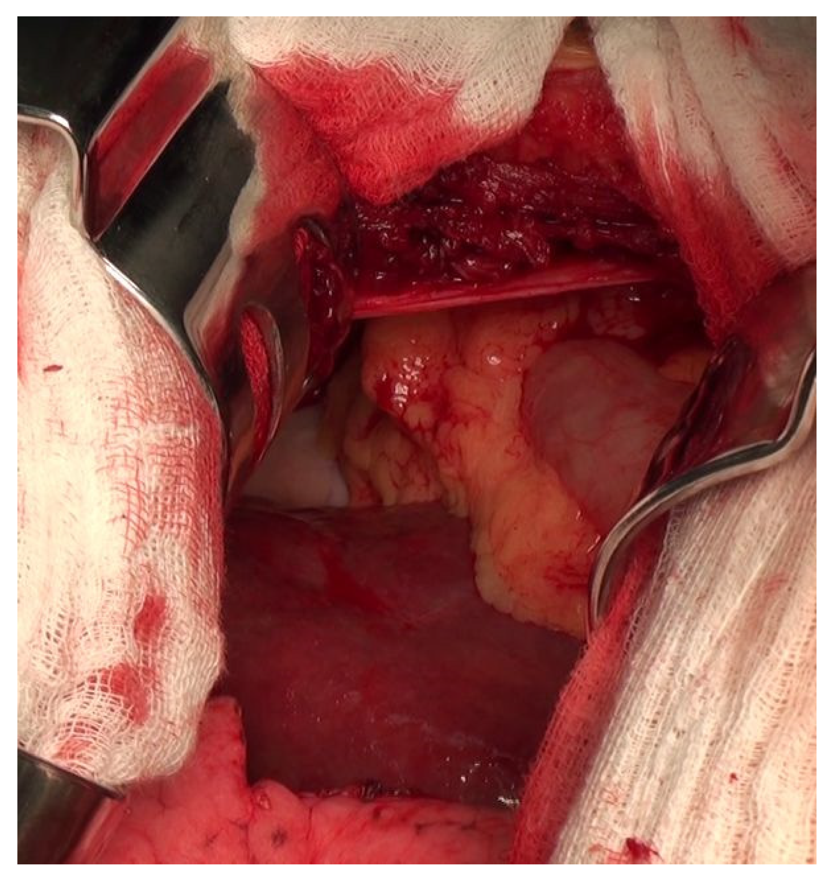 Diagnostics 14 00026 g006