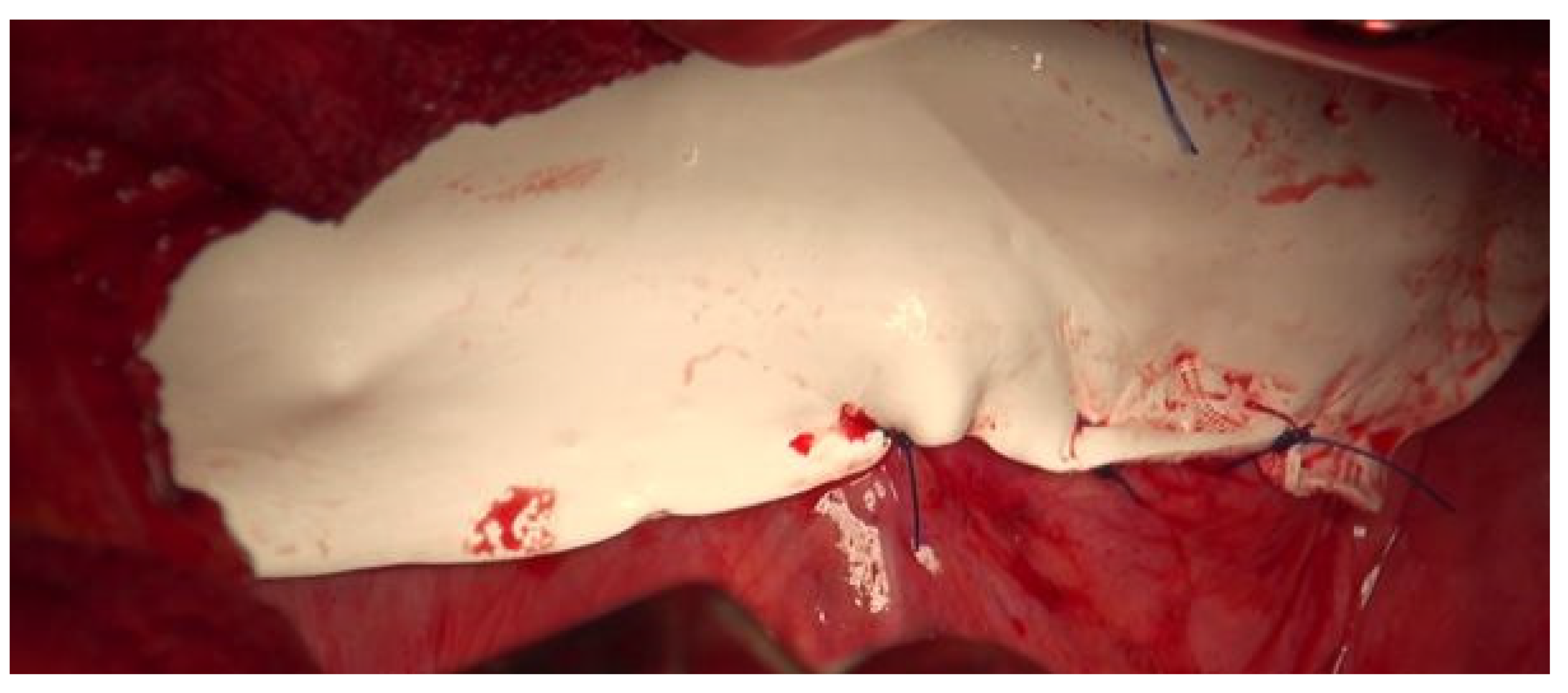 Diagnostics 14 00026 g007