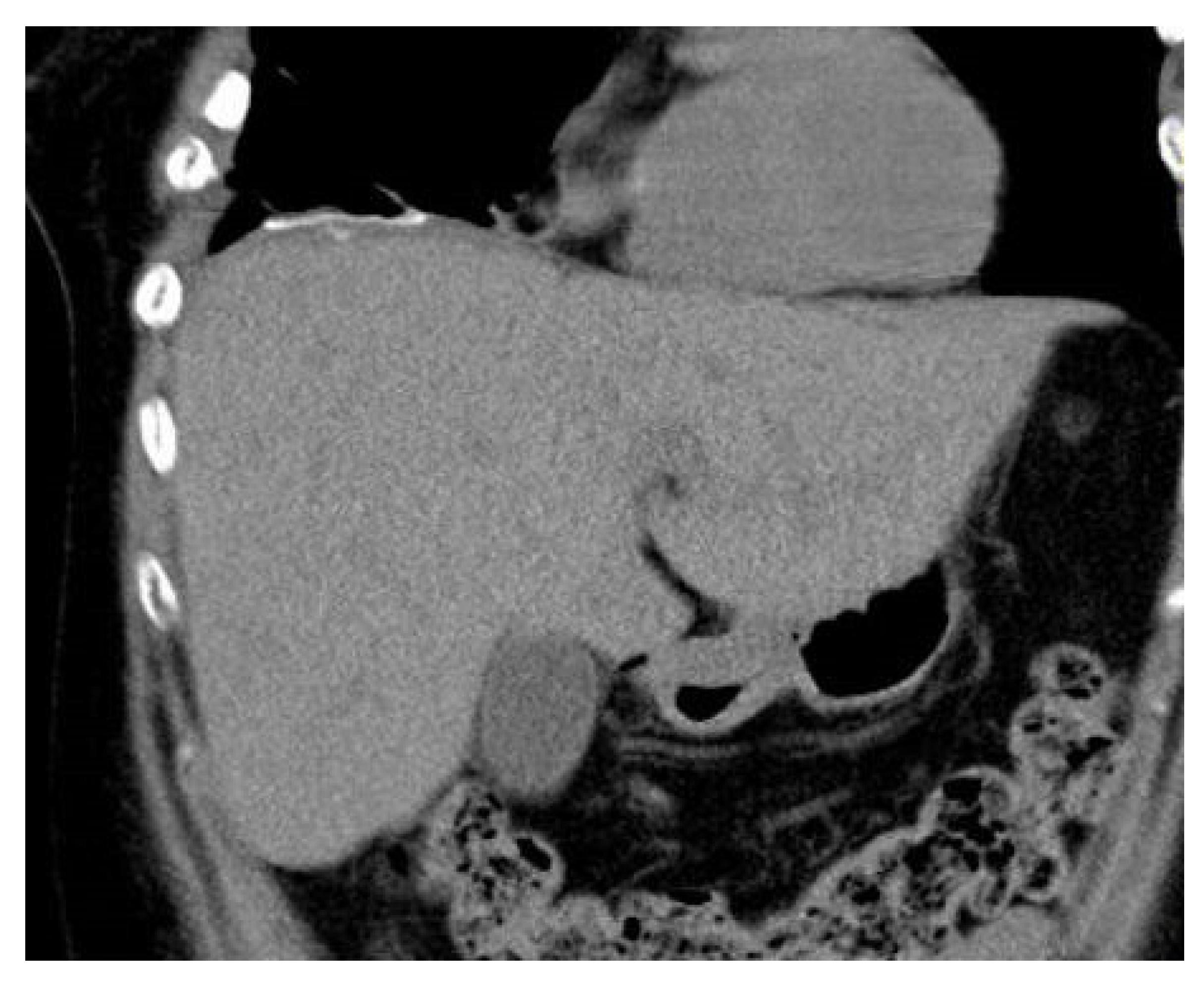 Diagnostics 14 00026 g008