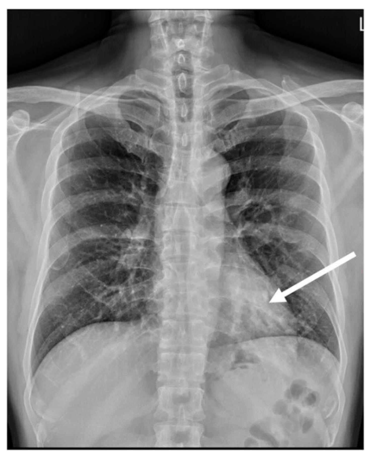 Diagnosi Prenatale – Gianturco Diagnosis