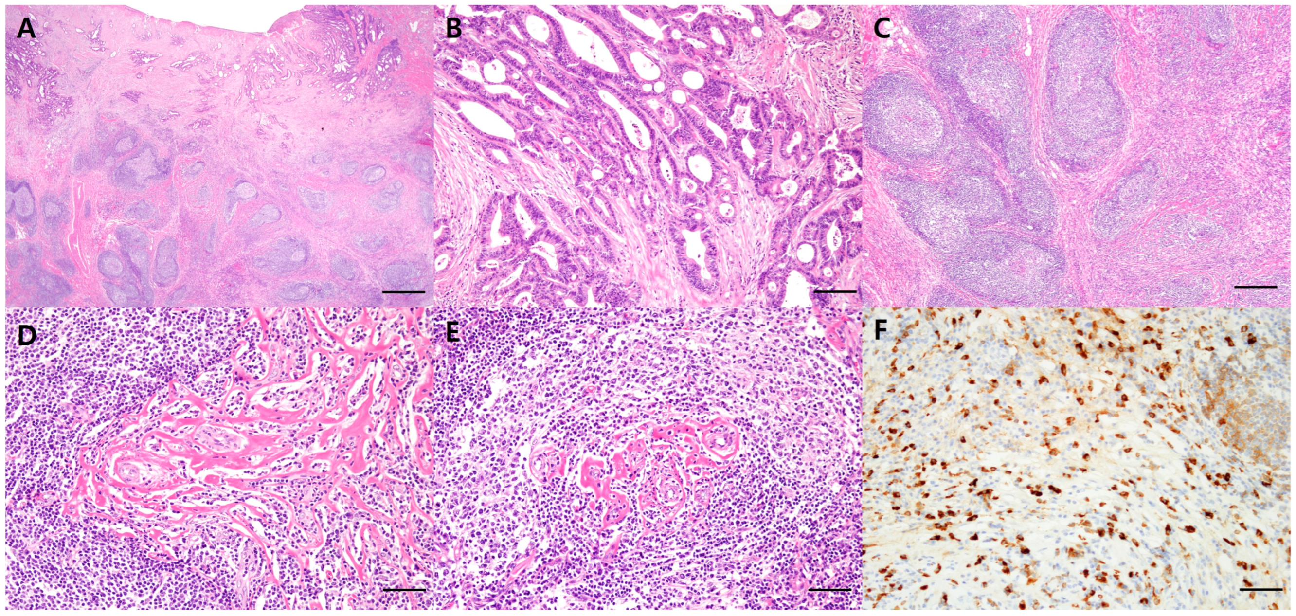 Diagnostics 14 00138 g002