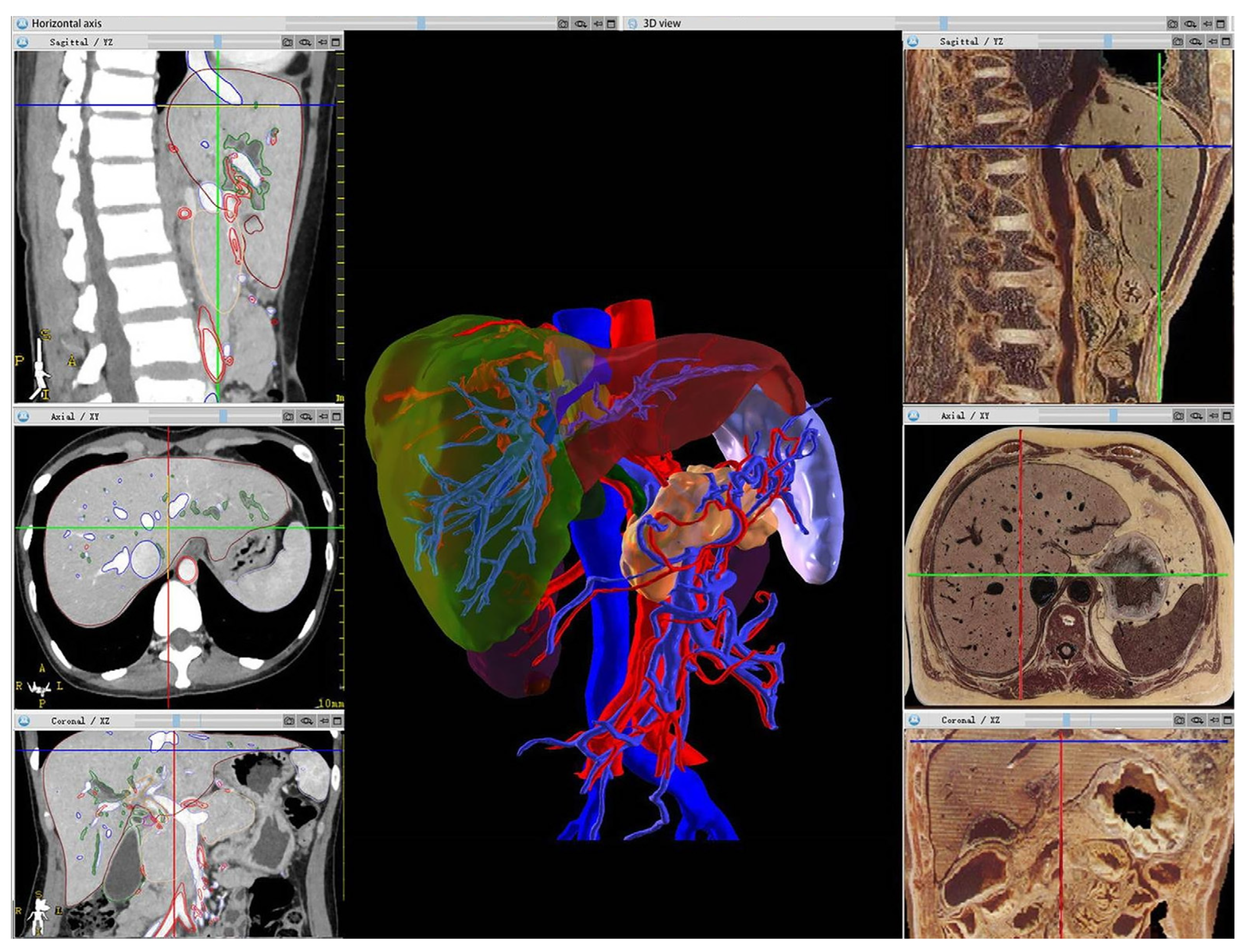 Diagnostics 14 00146 g003