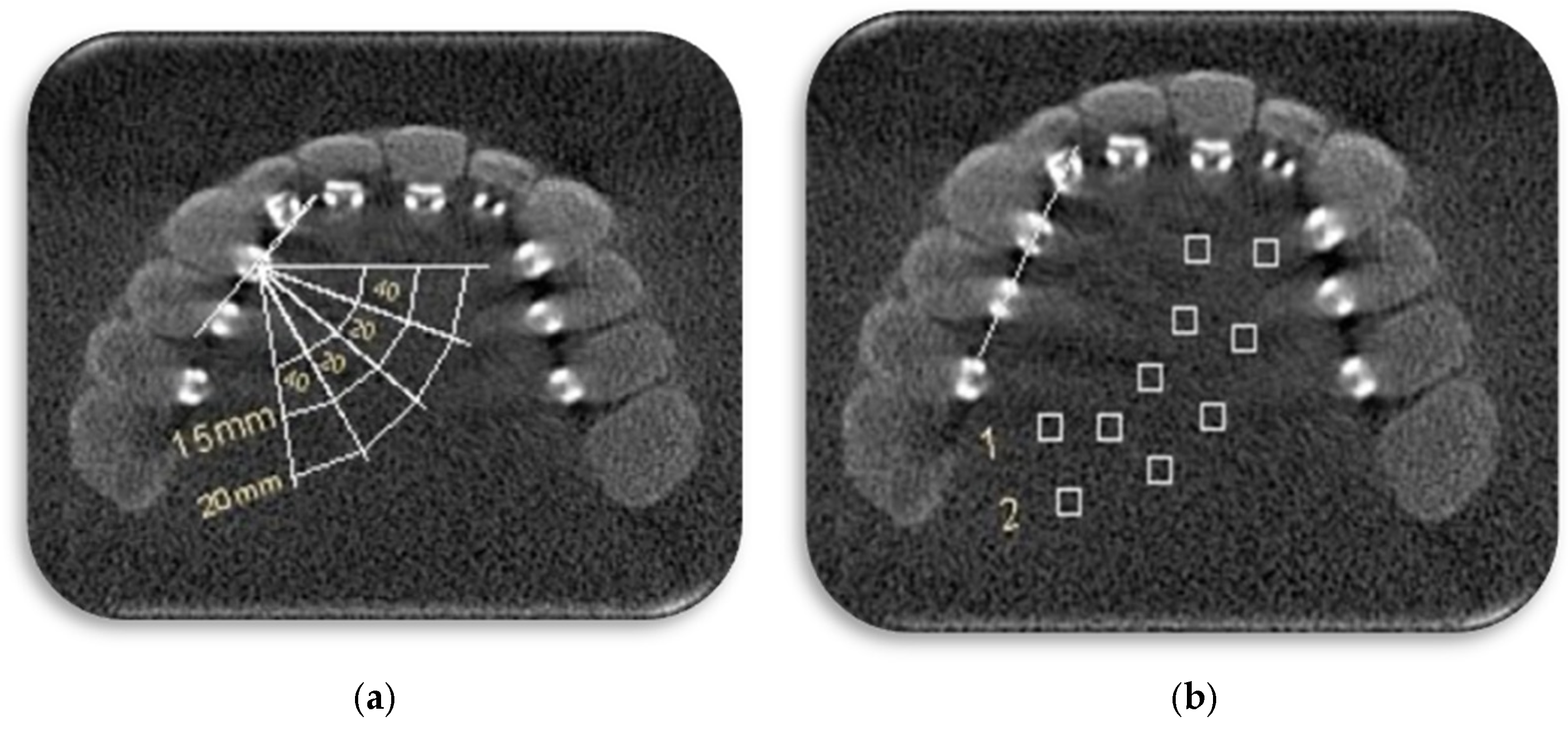 Diagnostics 14 00159 g001