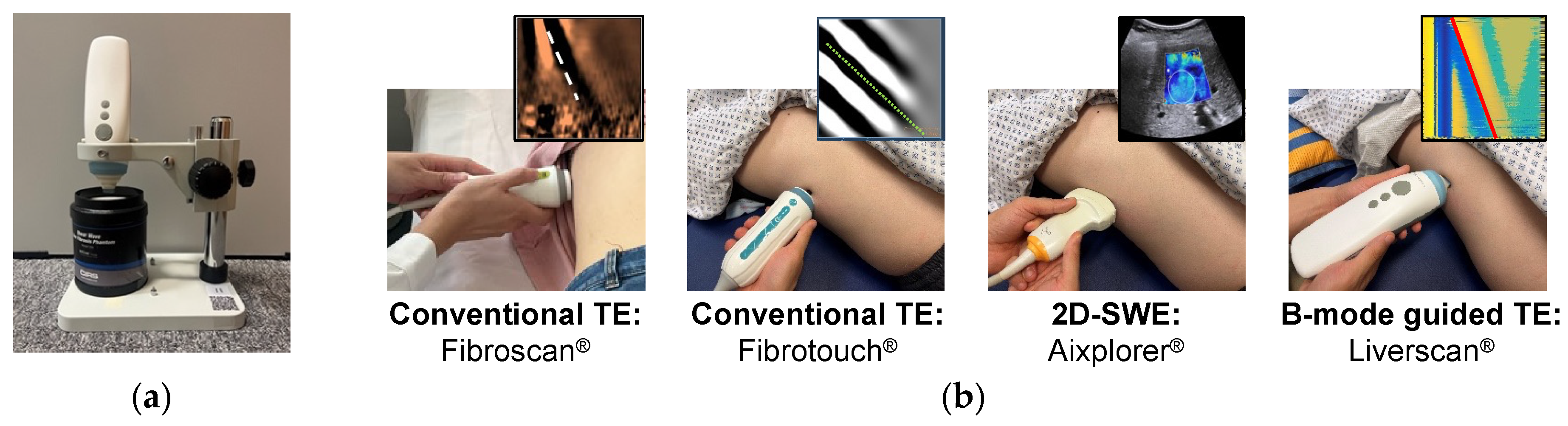 Real-Time B-Mode Ultrasound