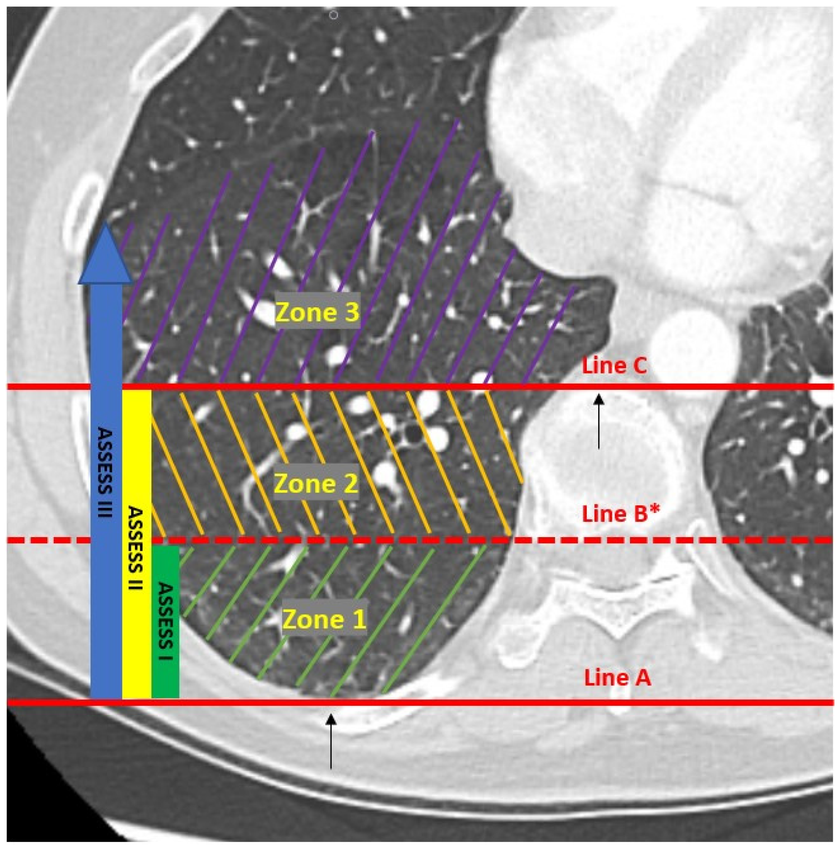 Diagnostics 14 00197 g001