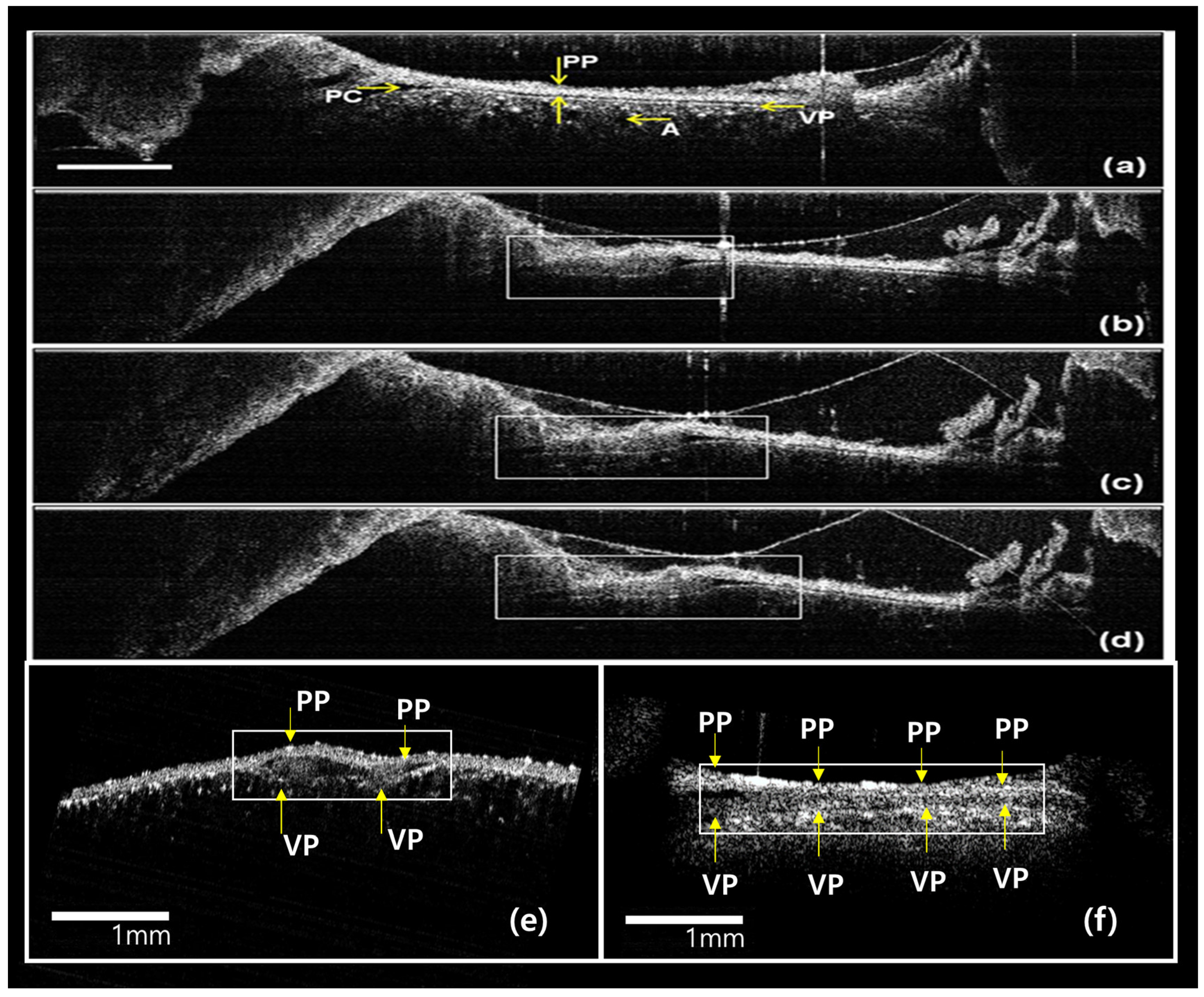 Diagnostics 14 00292 g005 Diagnostics 14 00292 g005
