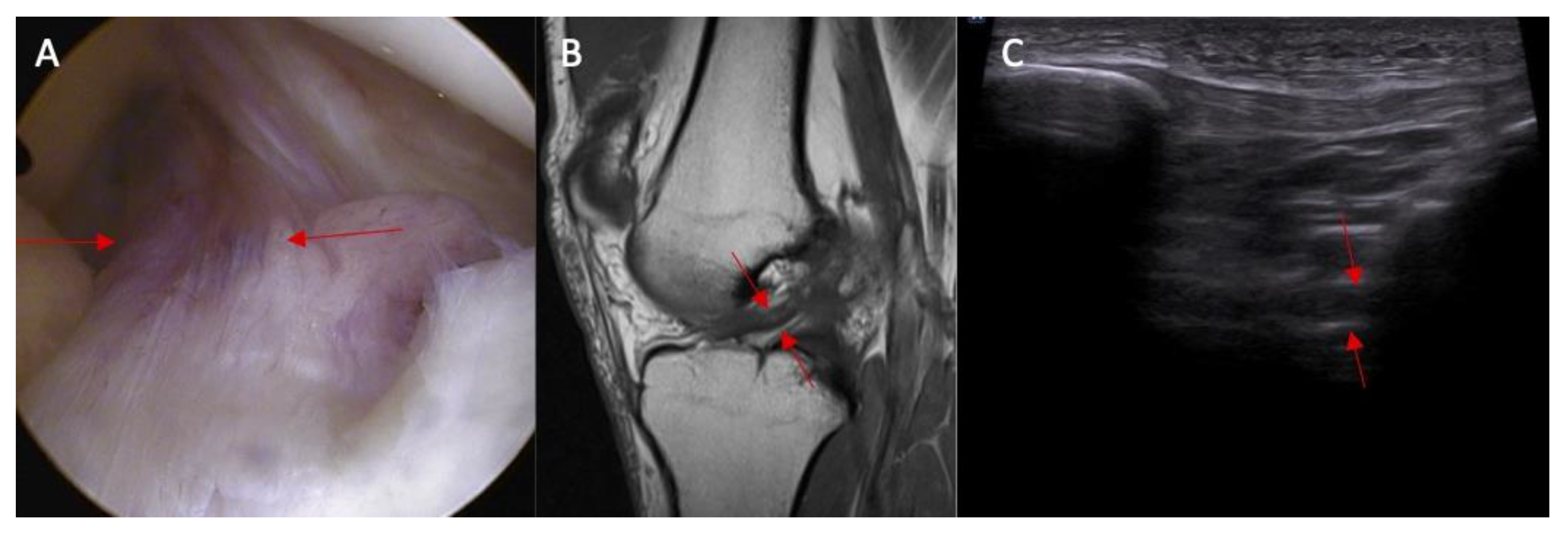 Diagnostics 14 00305 g004