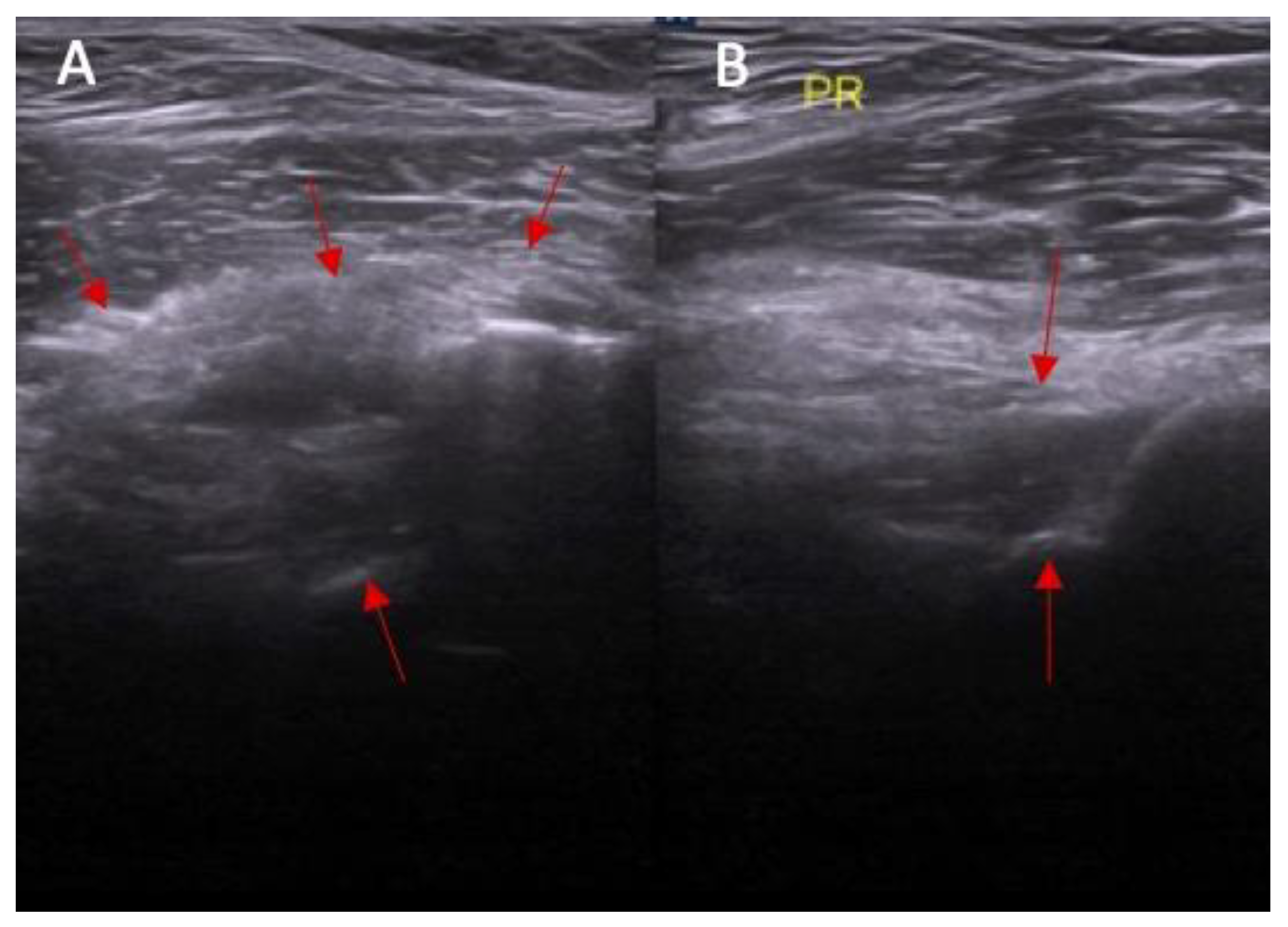 Diagnostics 14 00305 g006