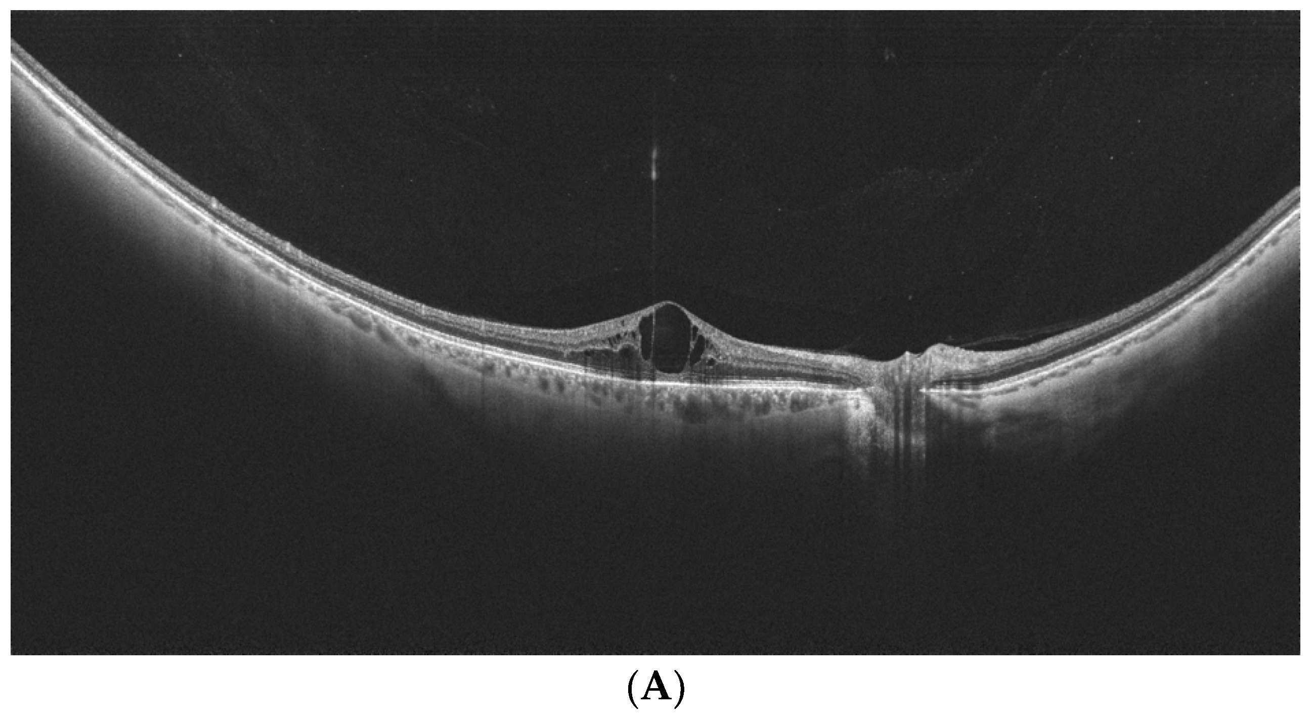 Diagnostics 14 00321 g003a Diagnostics 14 00321 g003a
