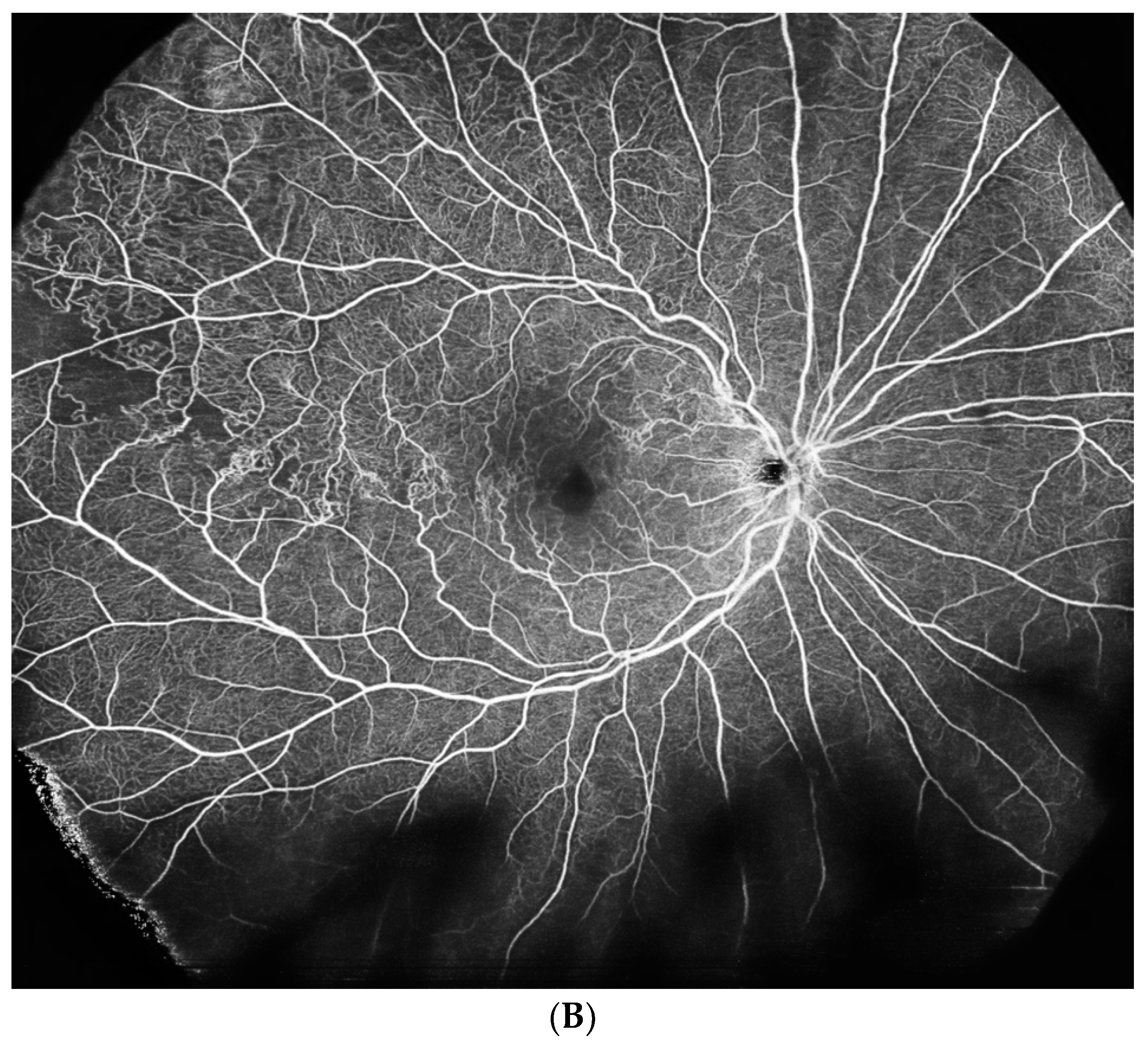 Diagnostics 14 00321 g003b Diagnostics 14 00321 g003b