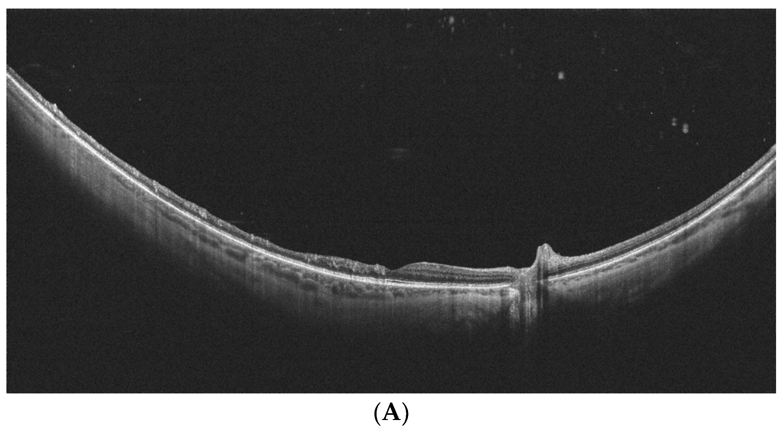 Diagnostics 14 00321 g004a Diagnostics 14 00321 g004a