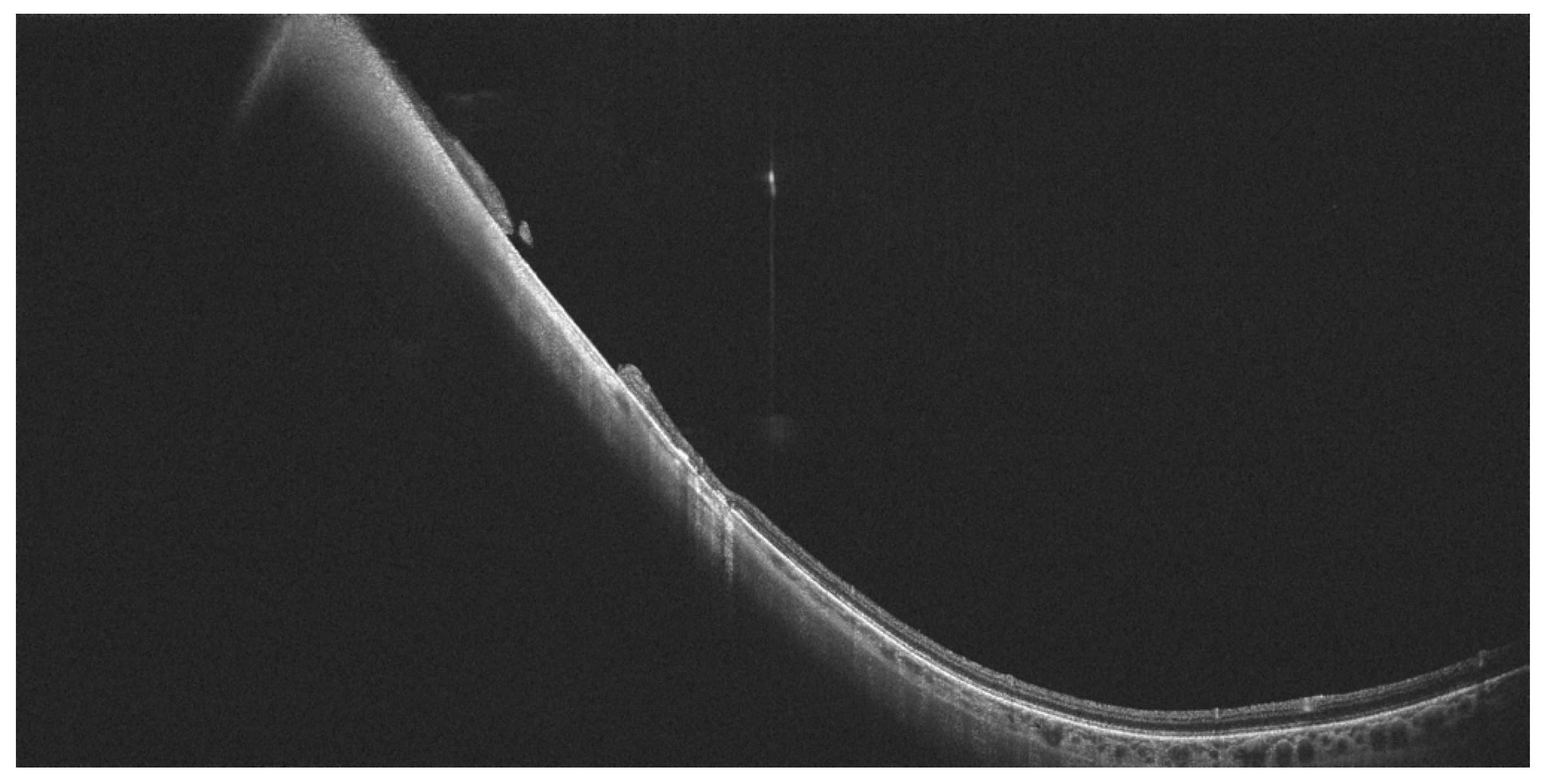 Diagnostics 14 00321 g006 Diagnostics 14 00321 g006