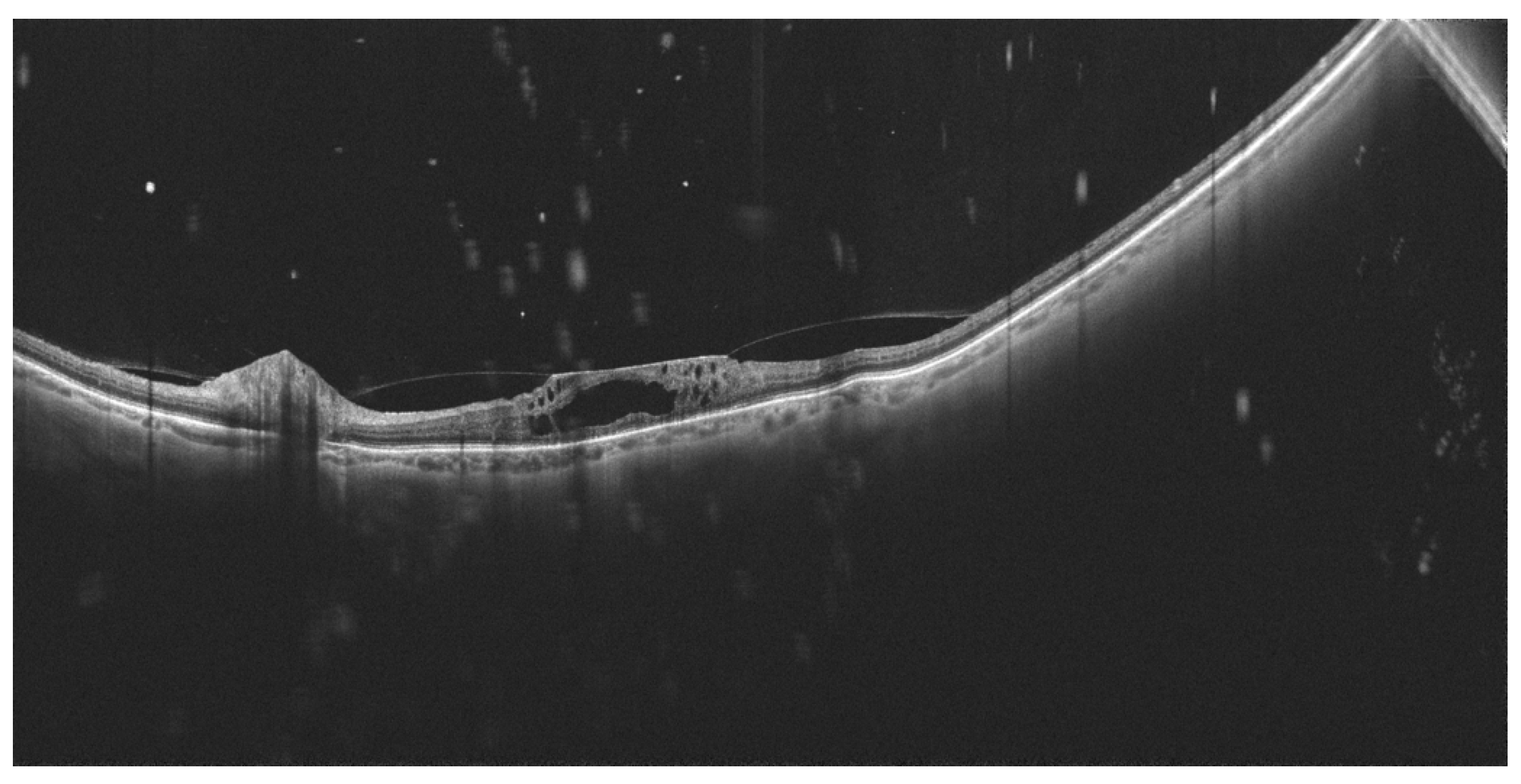 Diagnostics 14 00321 g007 Diagnostics 14 00321 g007