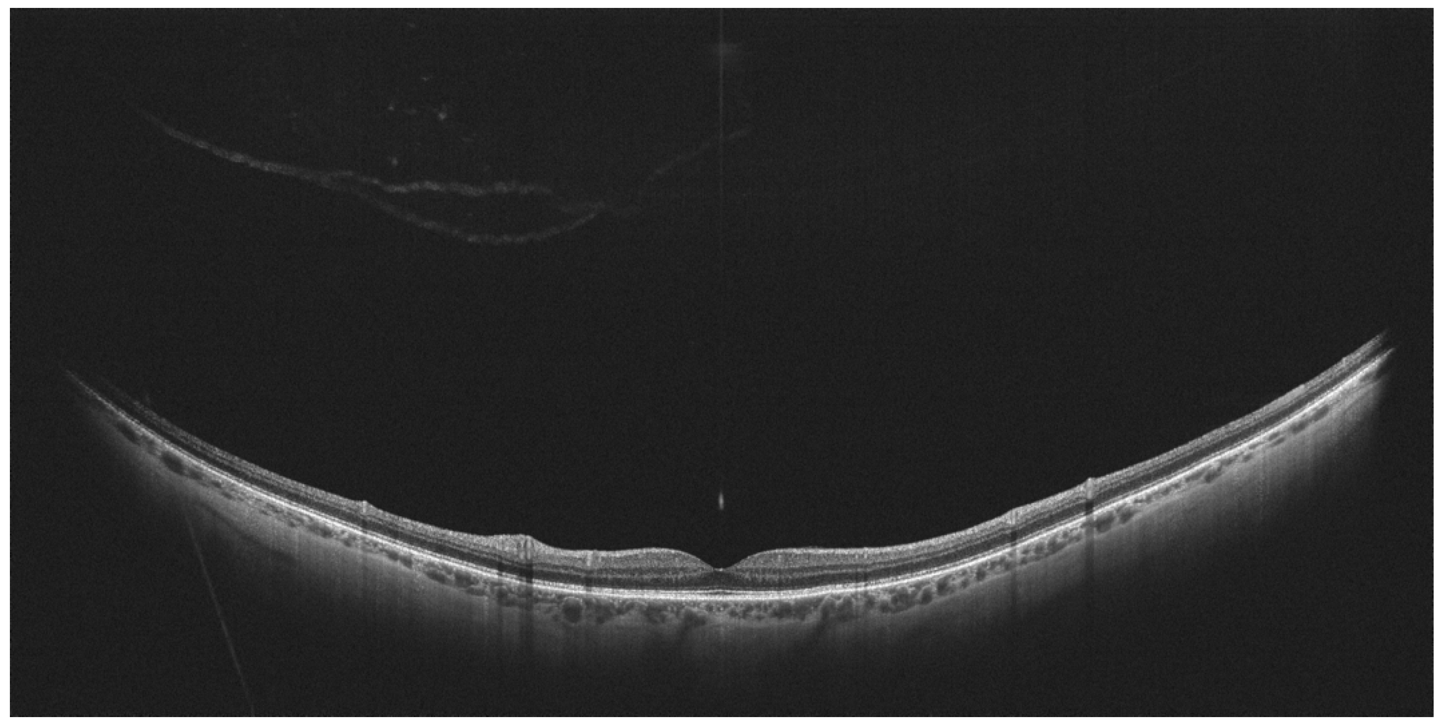Diagnostics 14 00321 g008 Diagnostics 14 00321 g008