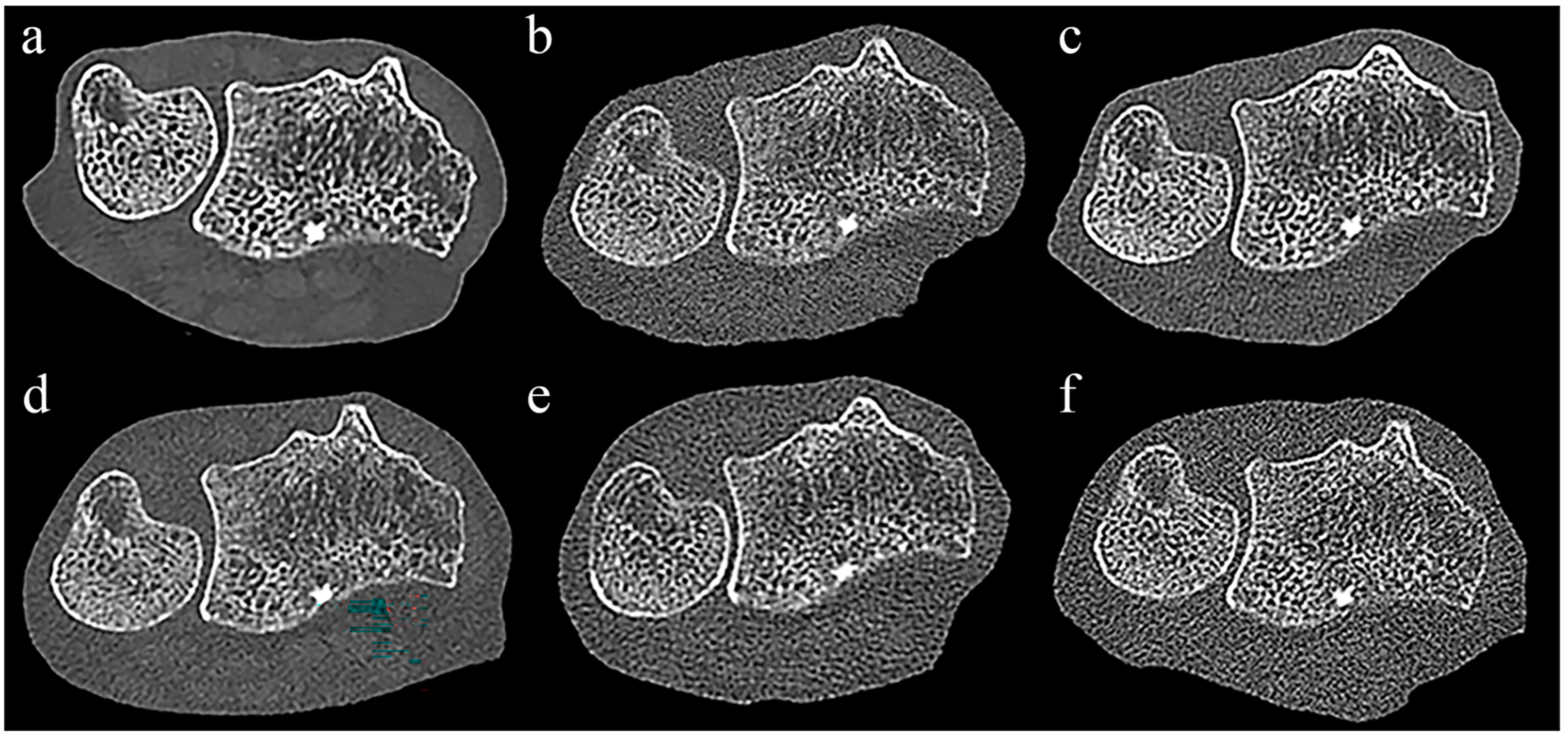 Diagnostics, Free Full-Text