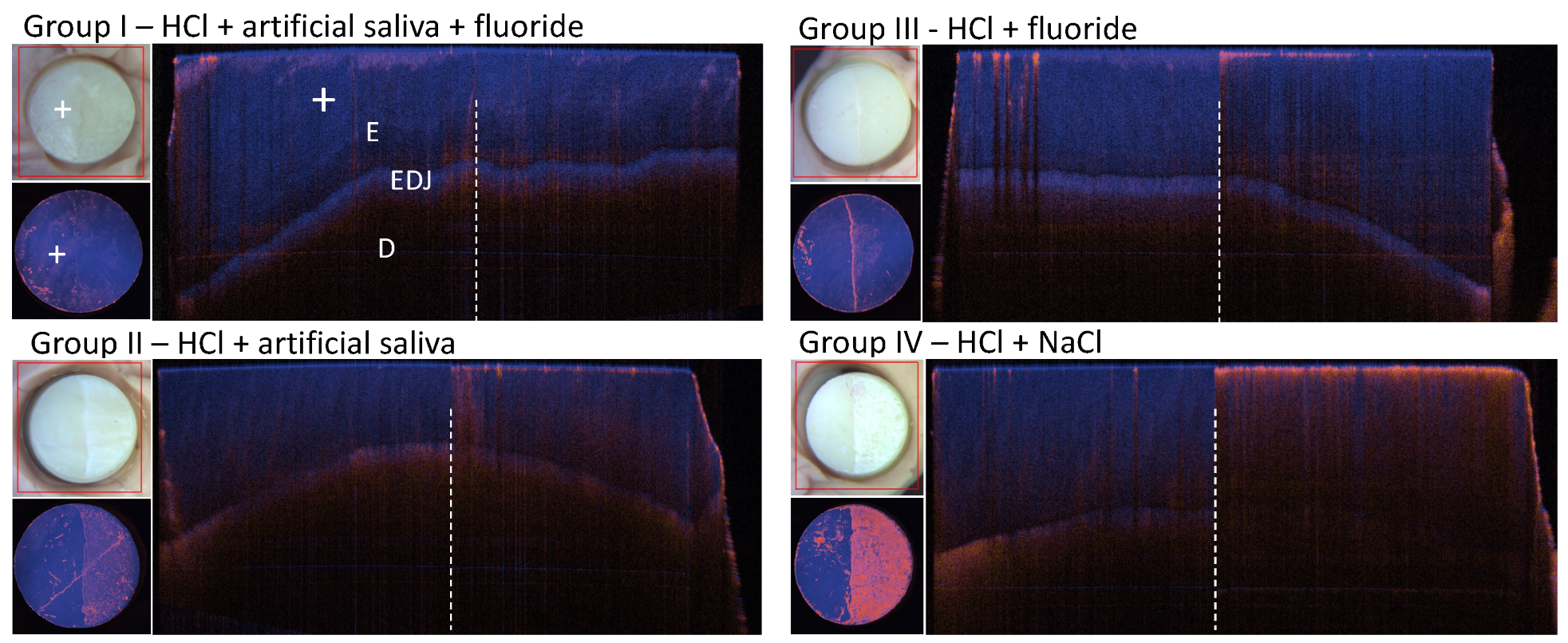 Diagnostics 14 00367 g006