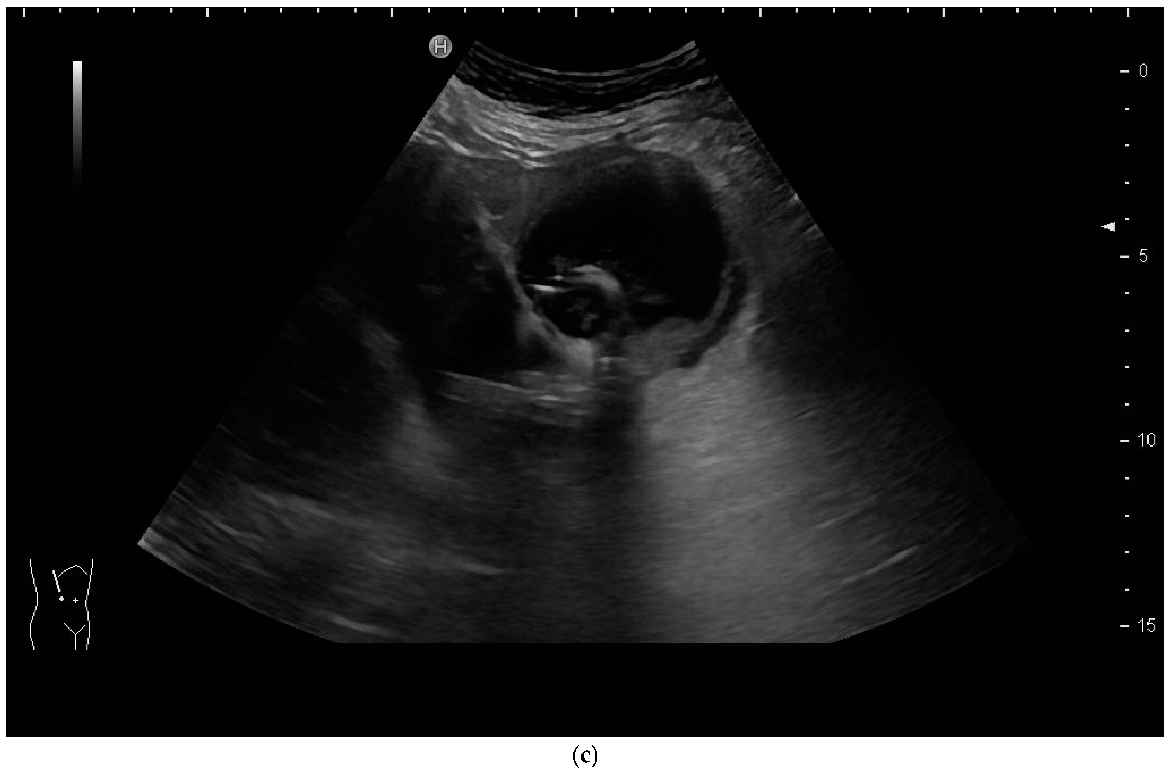 Diagnostics 14 00403 g011b Diagnostics 14 00403 g011b