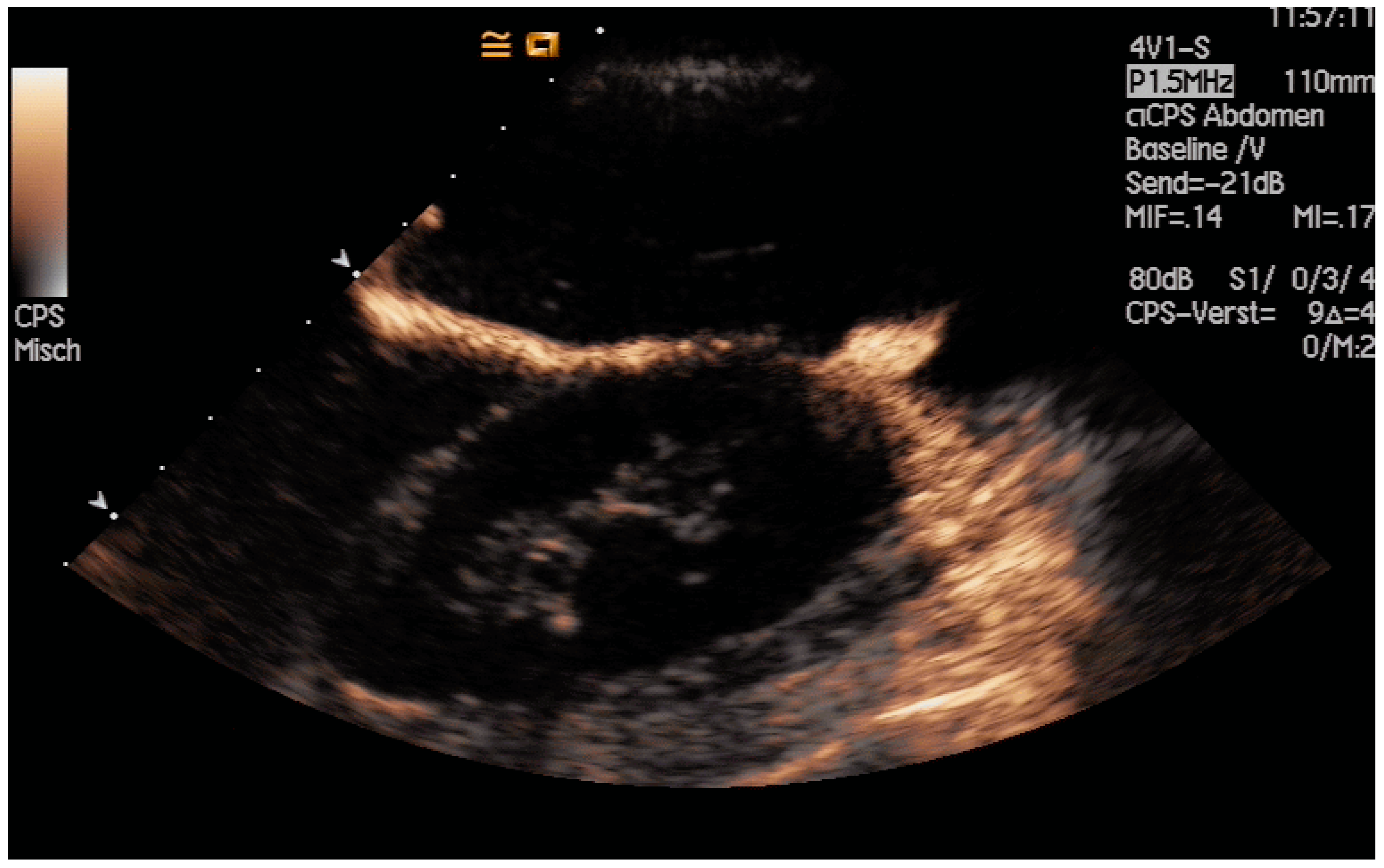 Diagnostics 14 00403 g013 Diagnostics 14 00403 g013