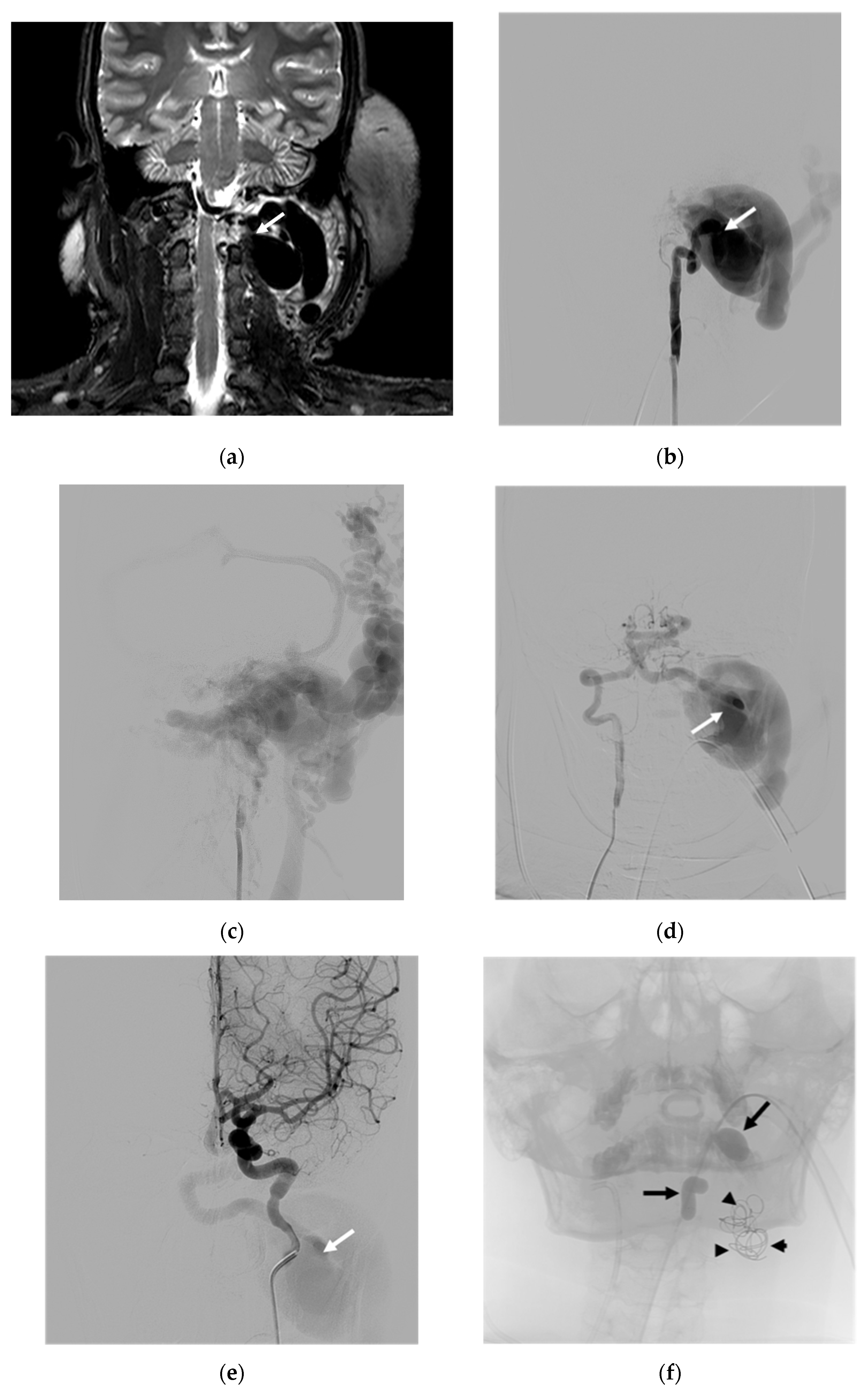 Diagnostics 14 00414 g001a