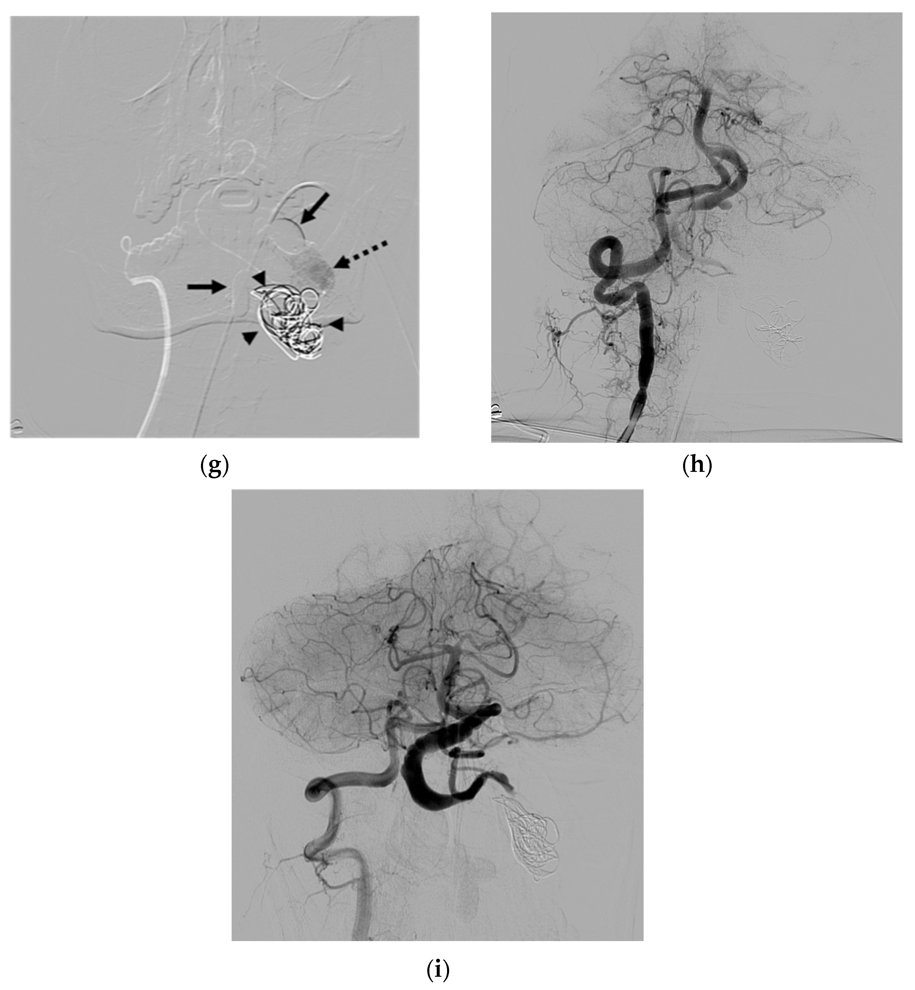 Diagnostics 14 00414 g001b