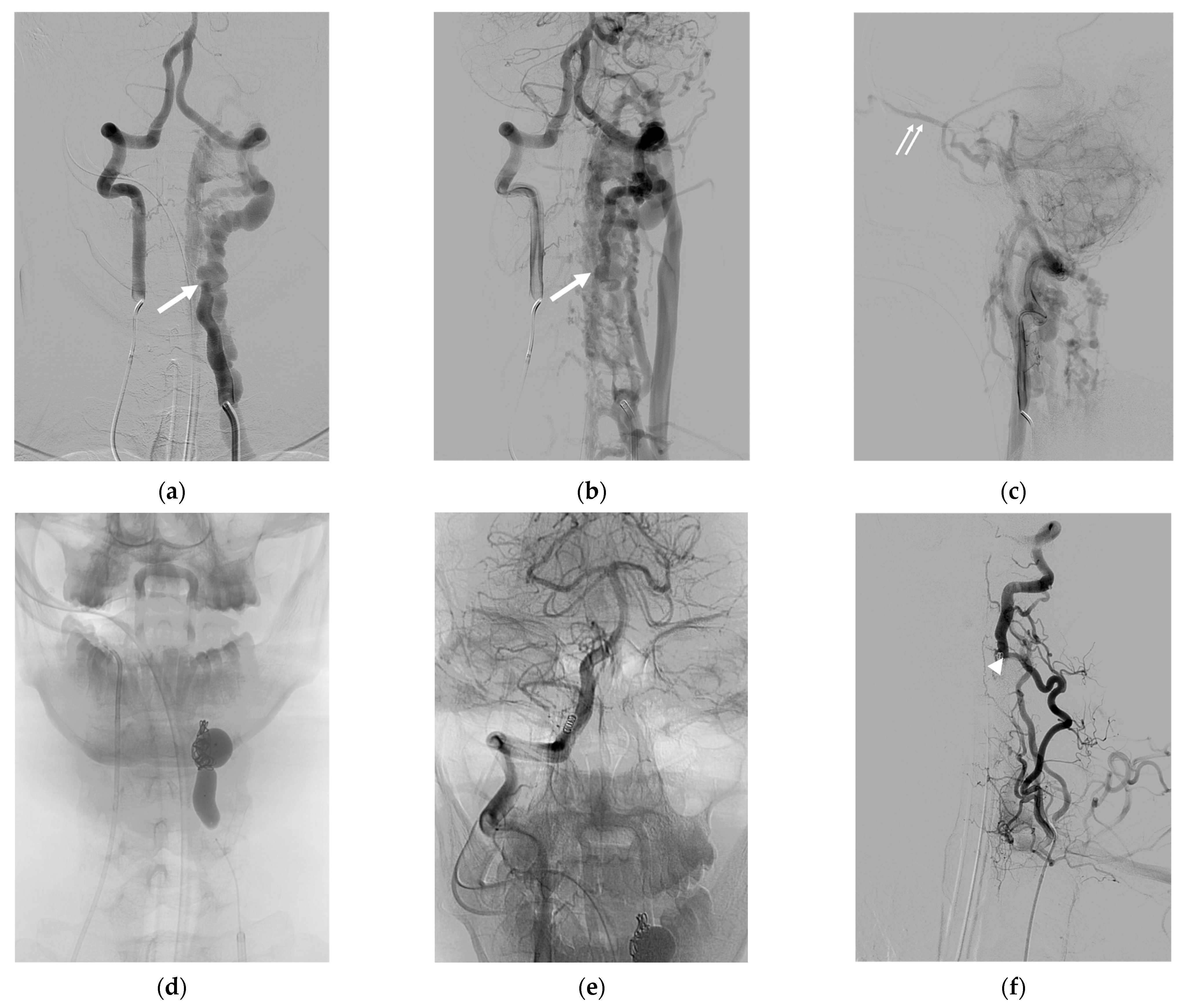 Diagnostics 14 00414 g002
