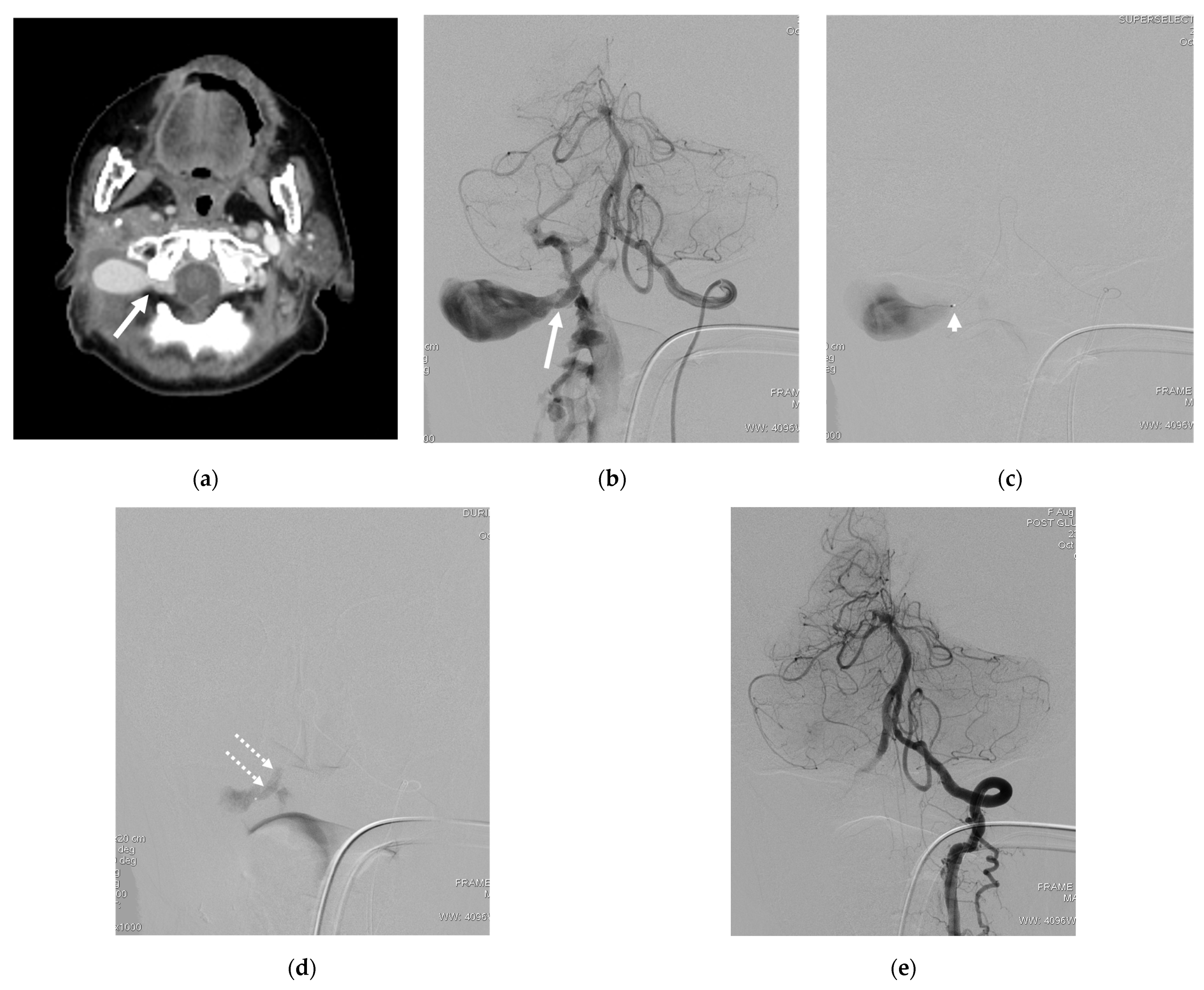Diagnostics 14 00414 g003